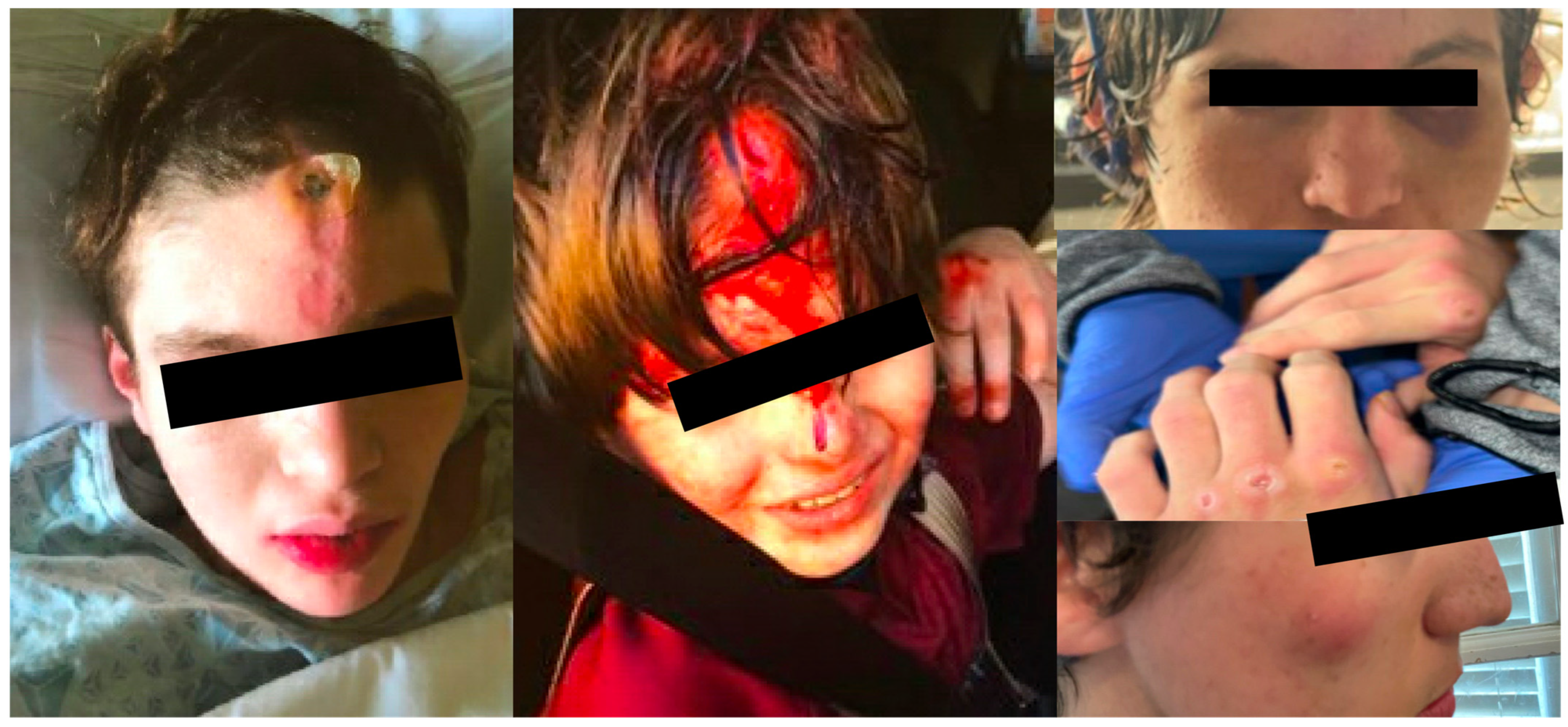 Toxins 15 00236 g004