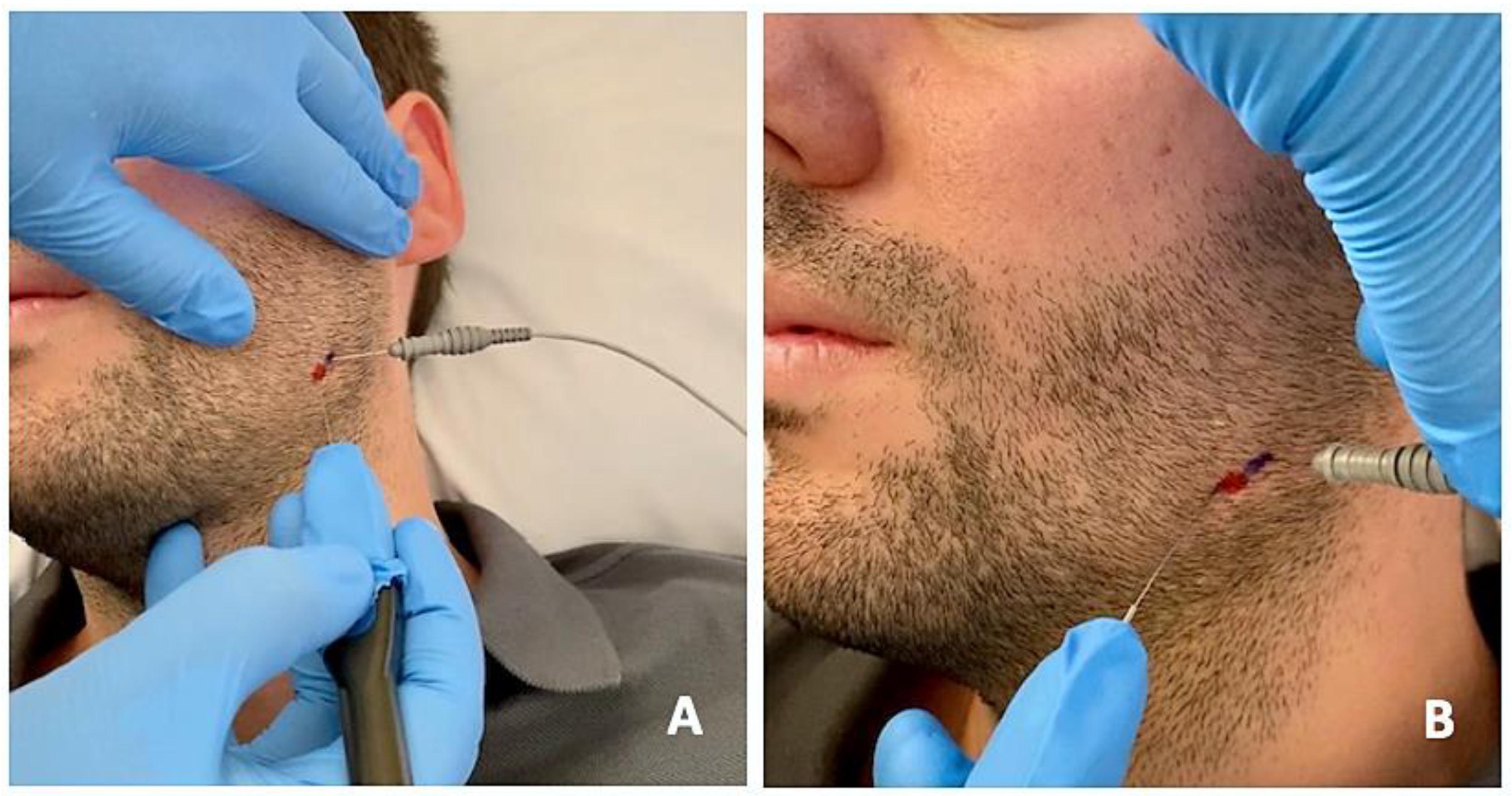 Toxins 15 00278 g003