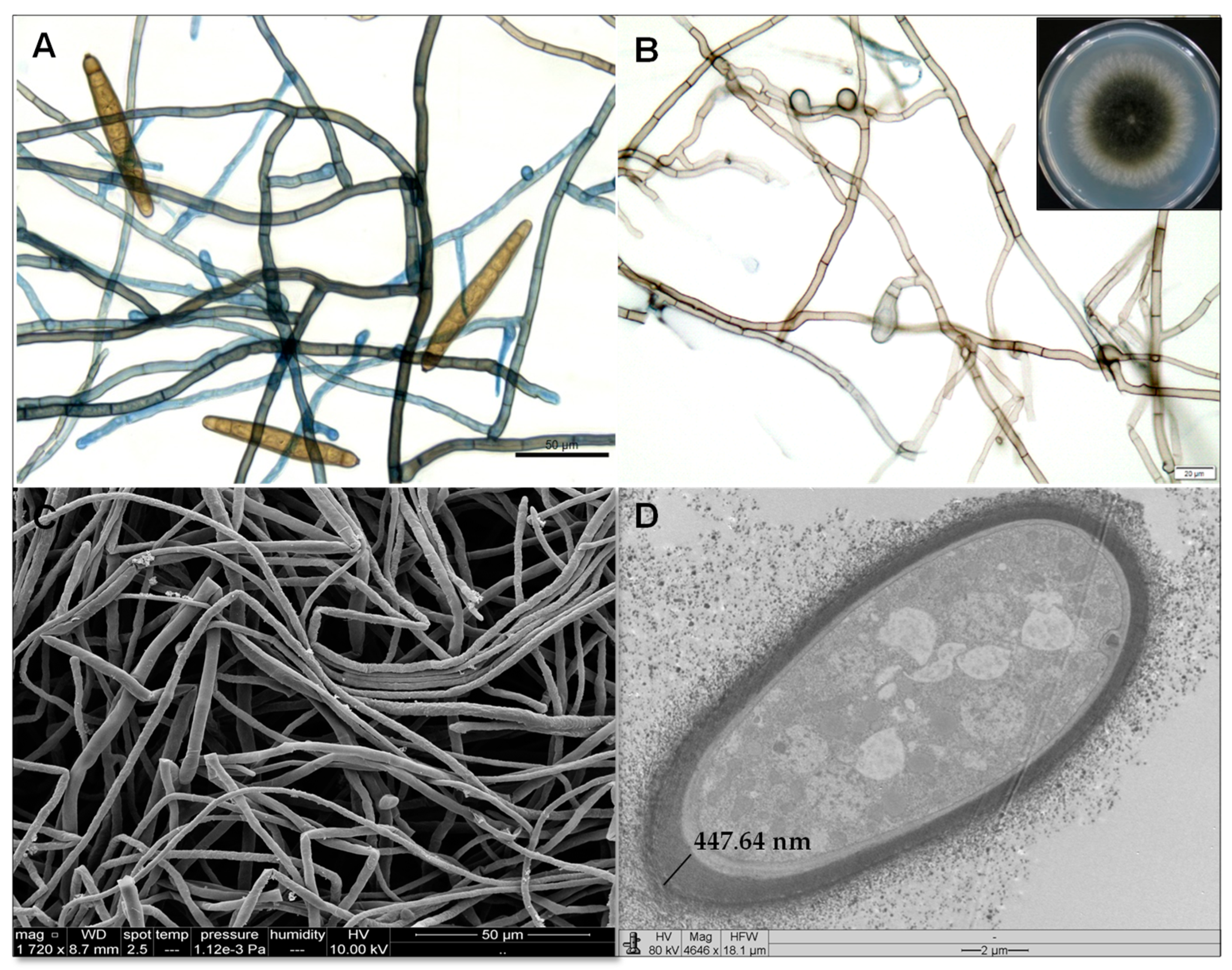 Toxins 15 00344 g002