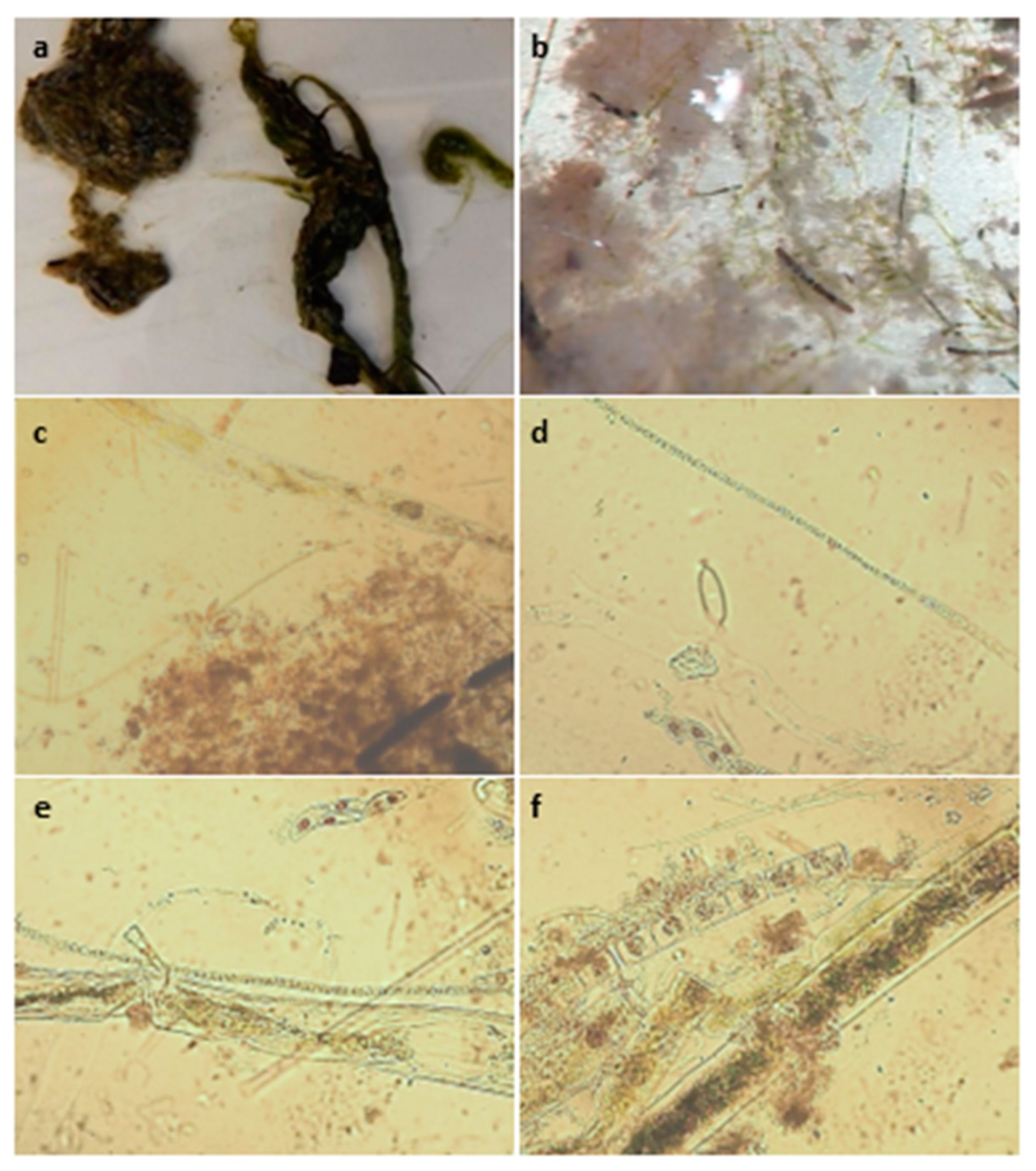 Toxins 15 00485 g002 Toxins 15 00485 g002