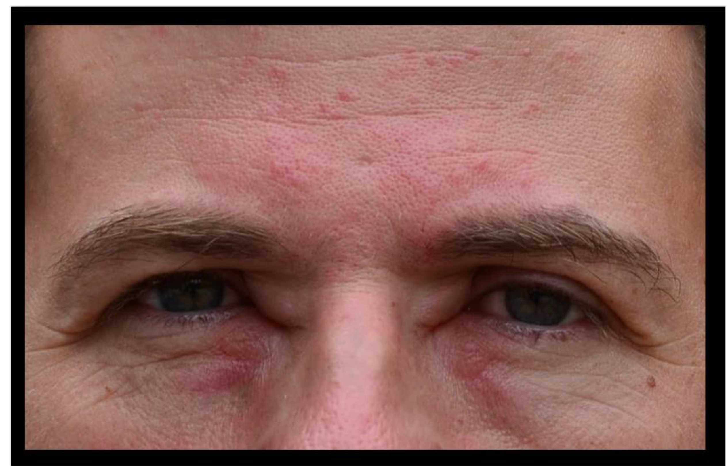 Toxins 15 00598 g003