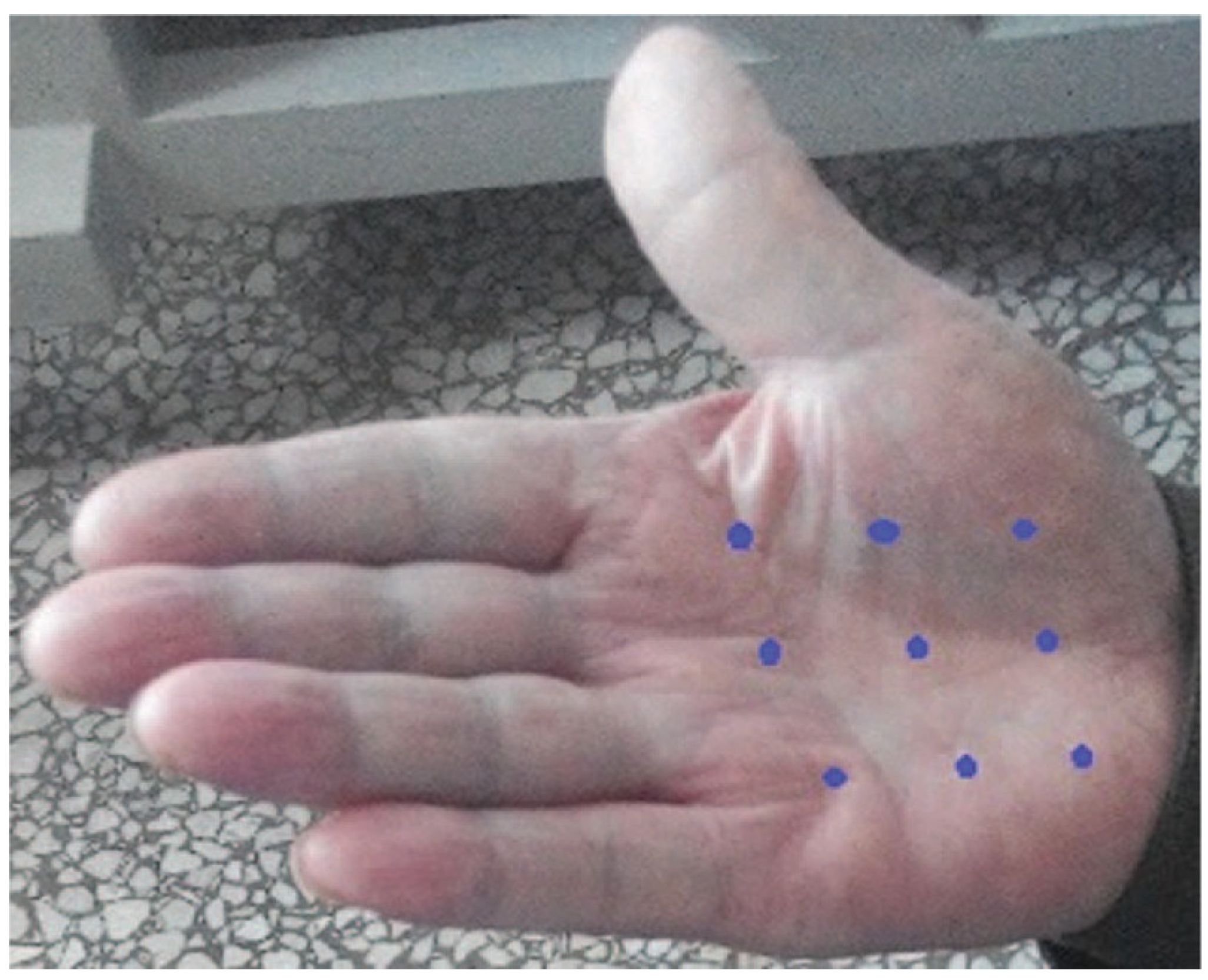 Toxins 15 00689 g004