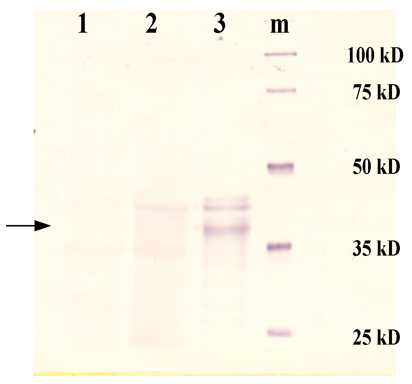 Toxins 16 00233 g004 Toxins 16 00233 g004