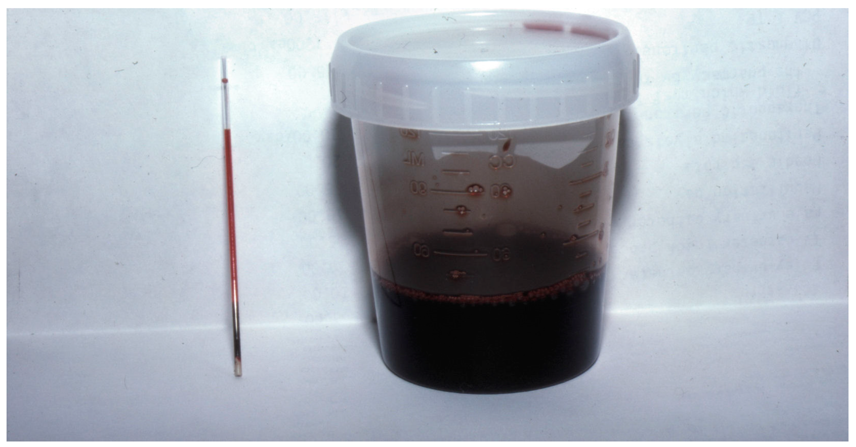 Toxins 16 00246 g002