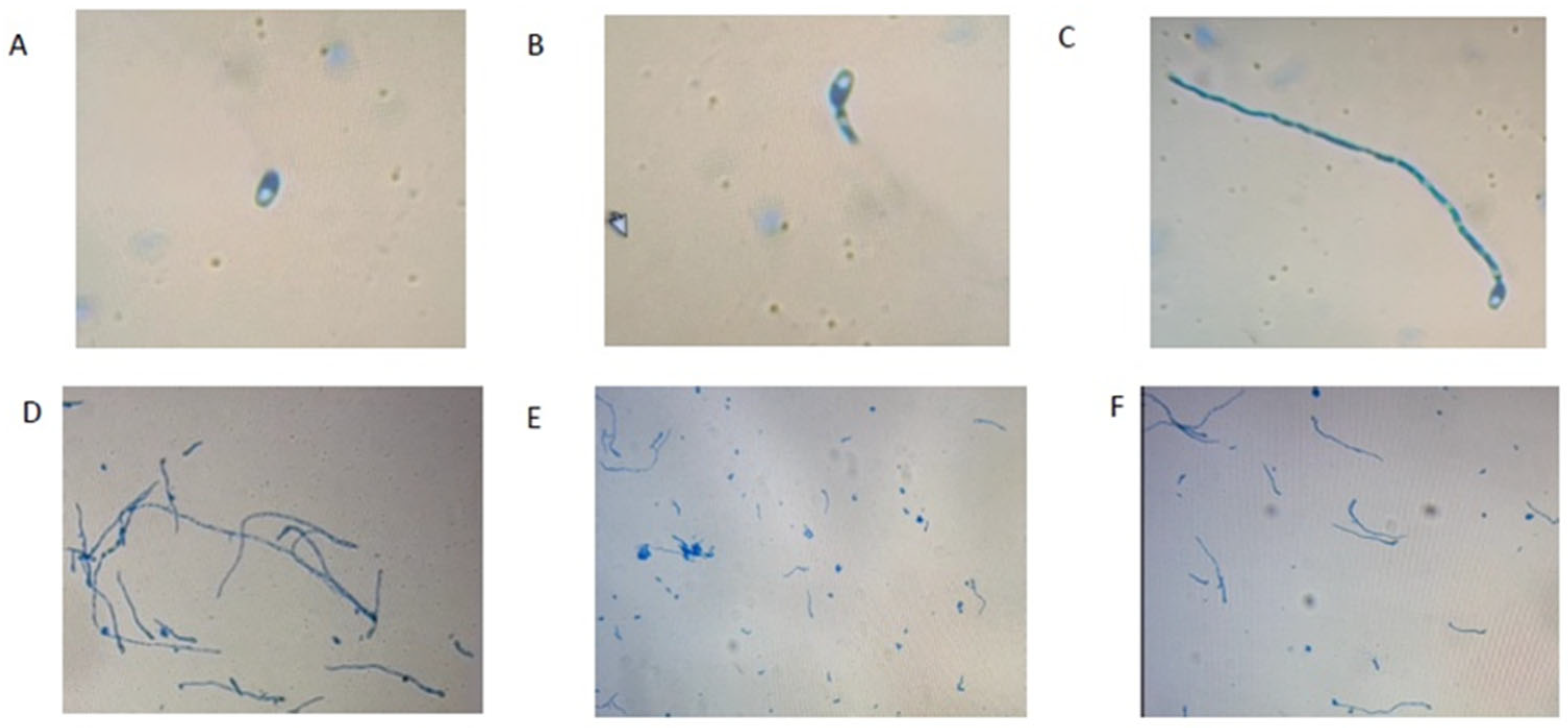 Toxins 16 00337 g003