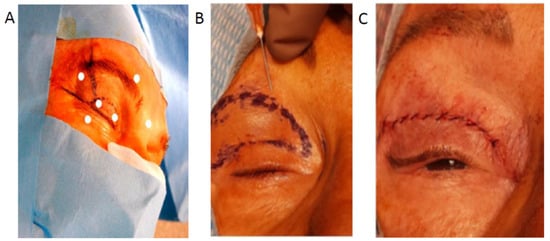 Toxins 16 00506 g0a1