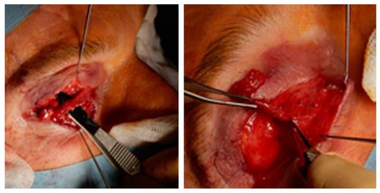 Toxins 16 00506 g0a2