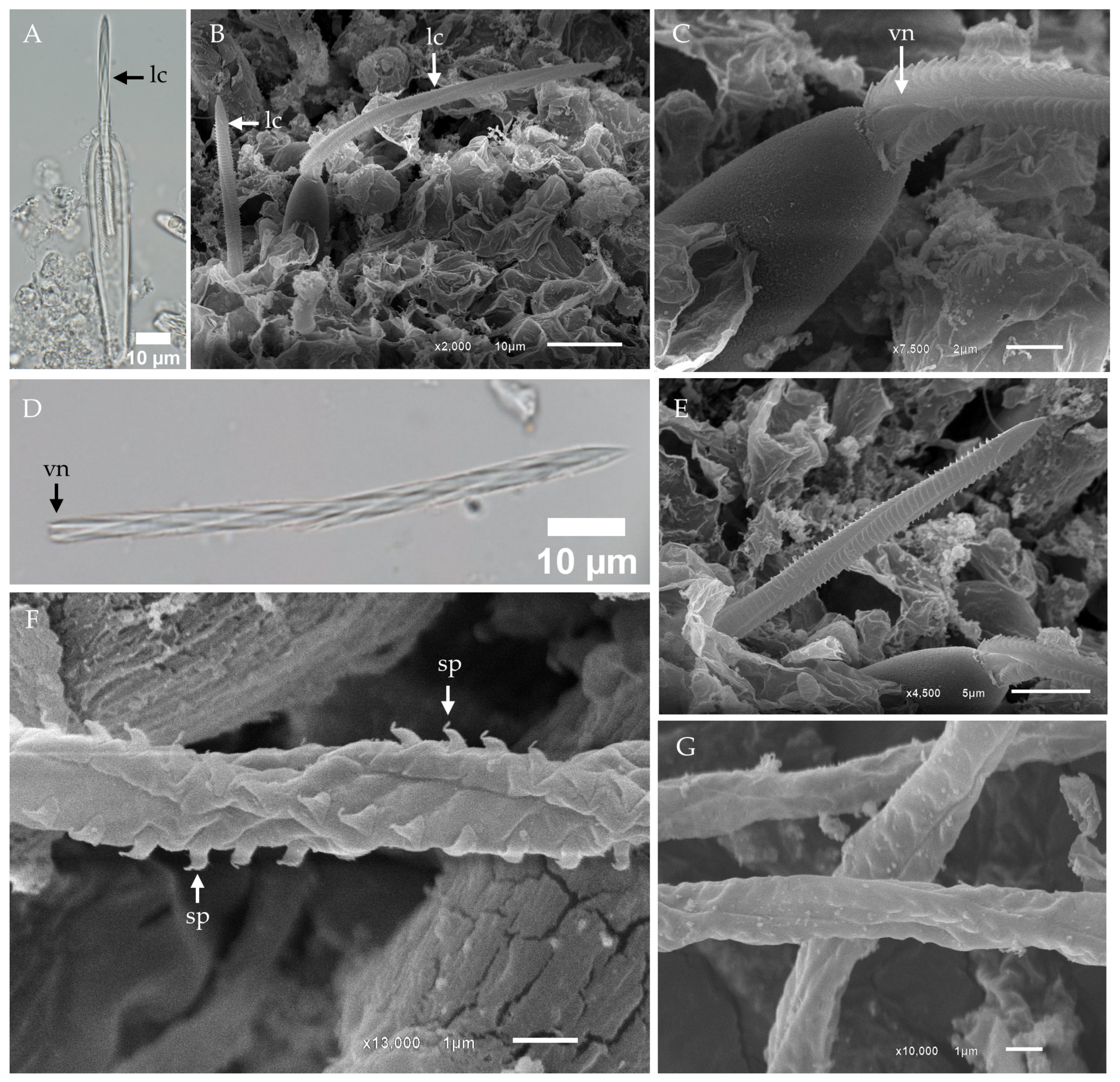 Toxins 17 00044 g002 Toxins 17 00044 g002