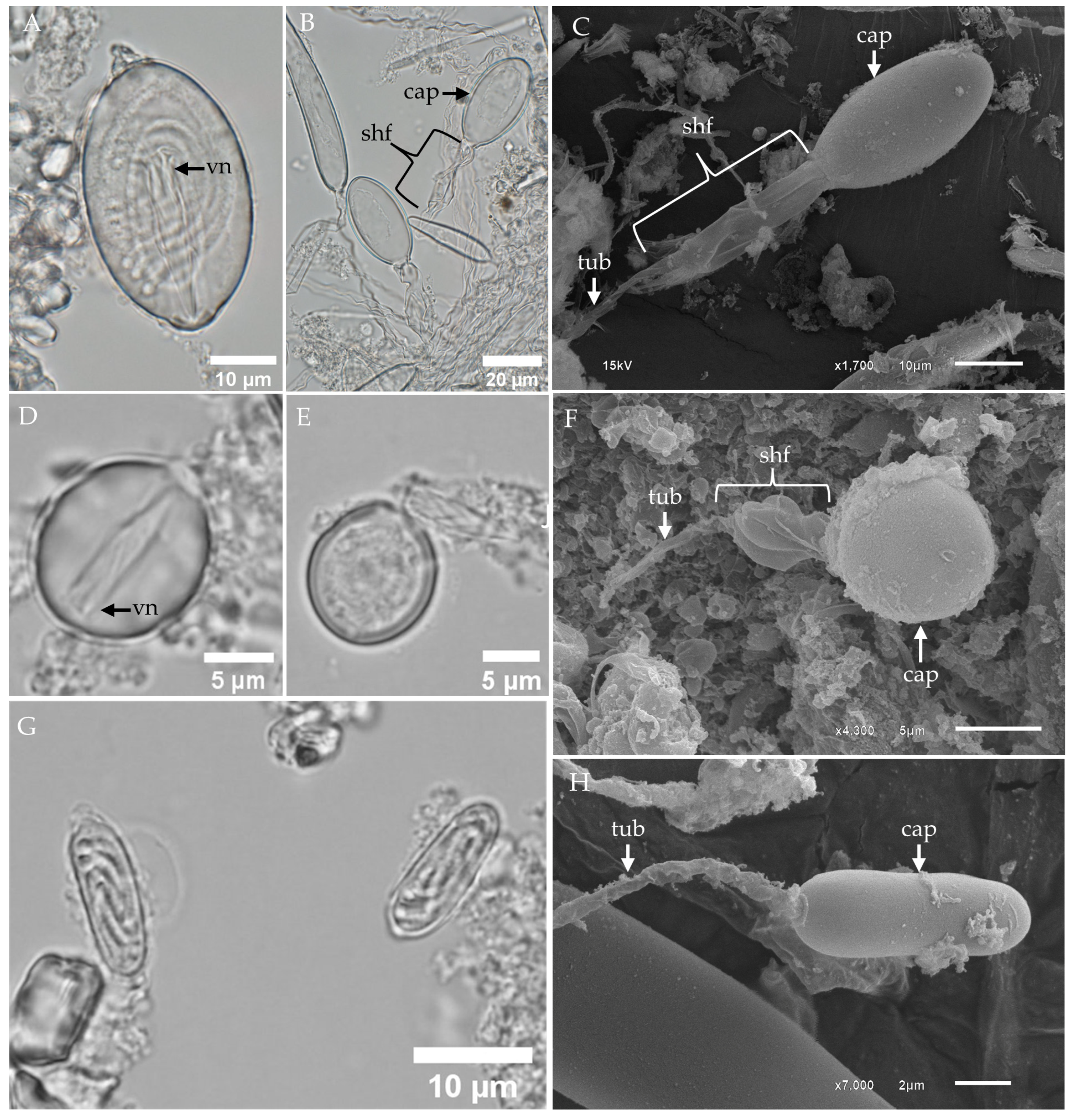 Toxins 17 00044 g003 Toxins 17 00044 g003