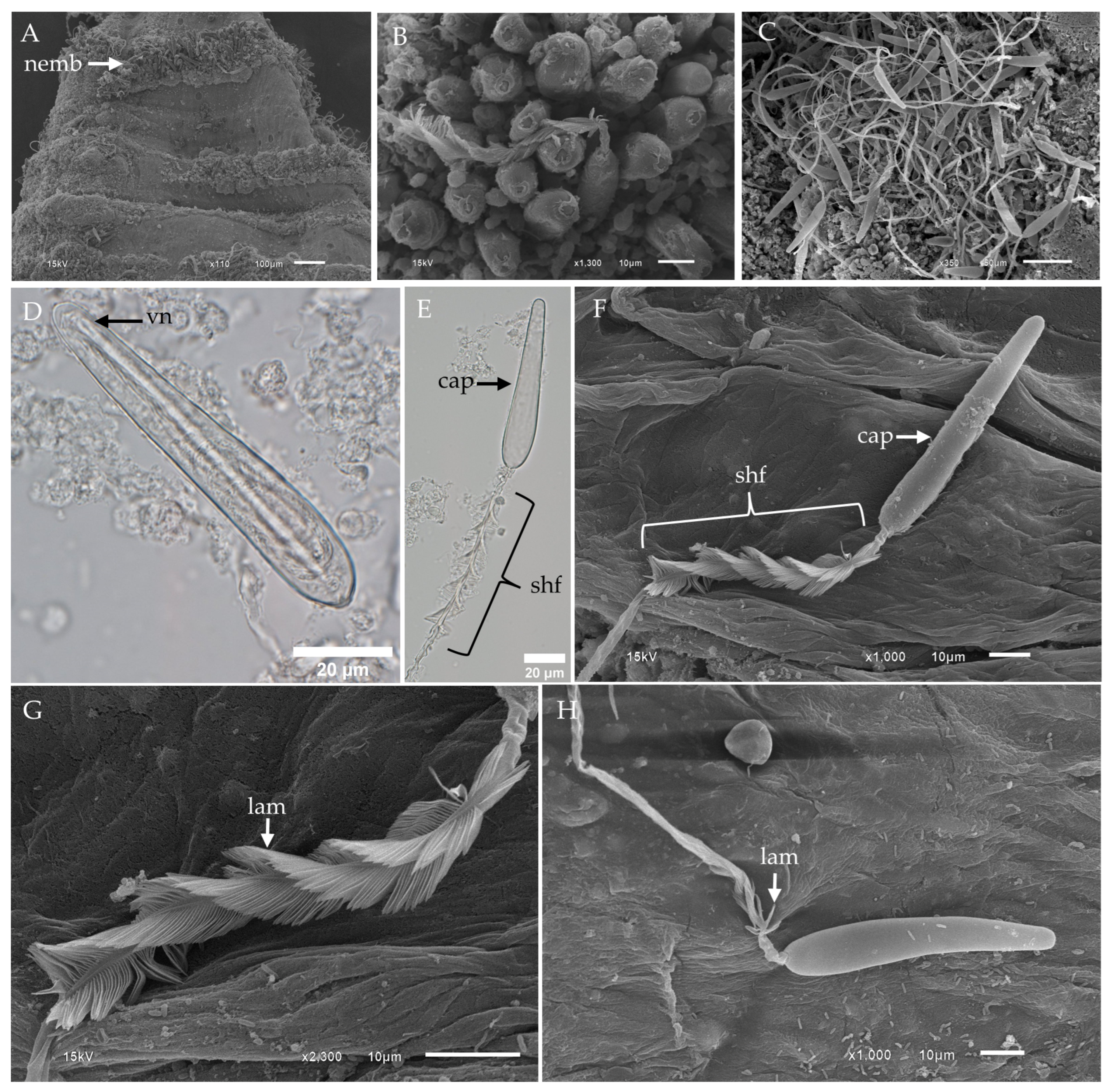 Toxins 17 00044 g004 Toxins 17 00044 g004