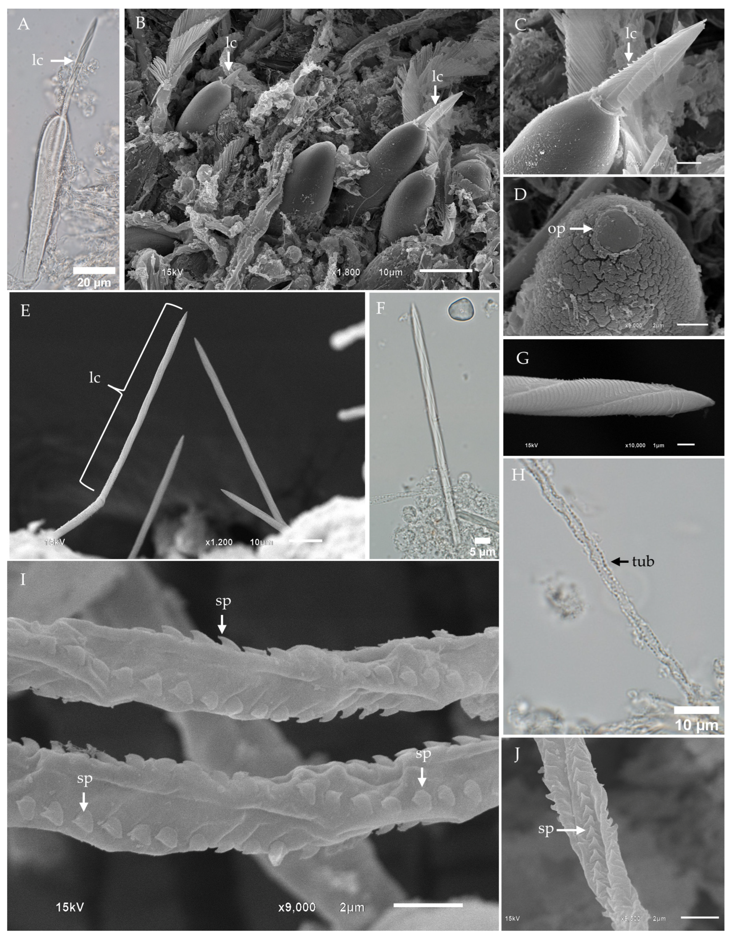 Toxins 17 00044 g005 Toxins 17 00044 g005