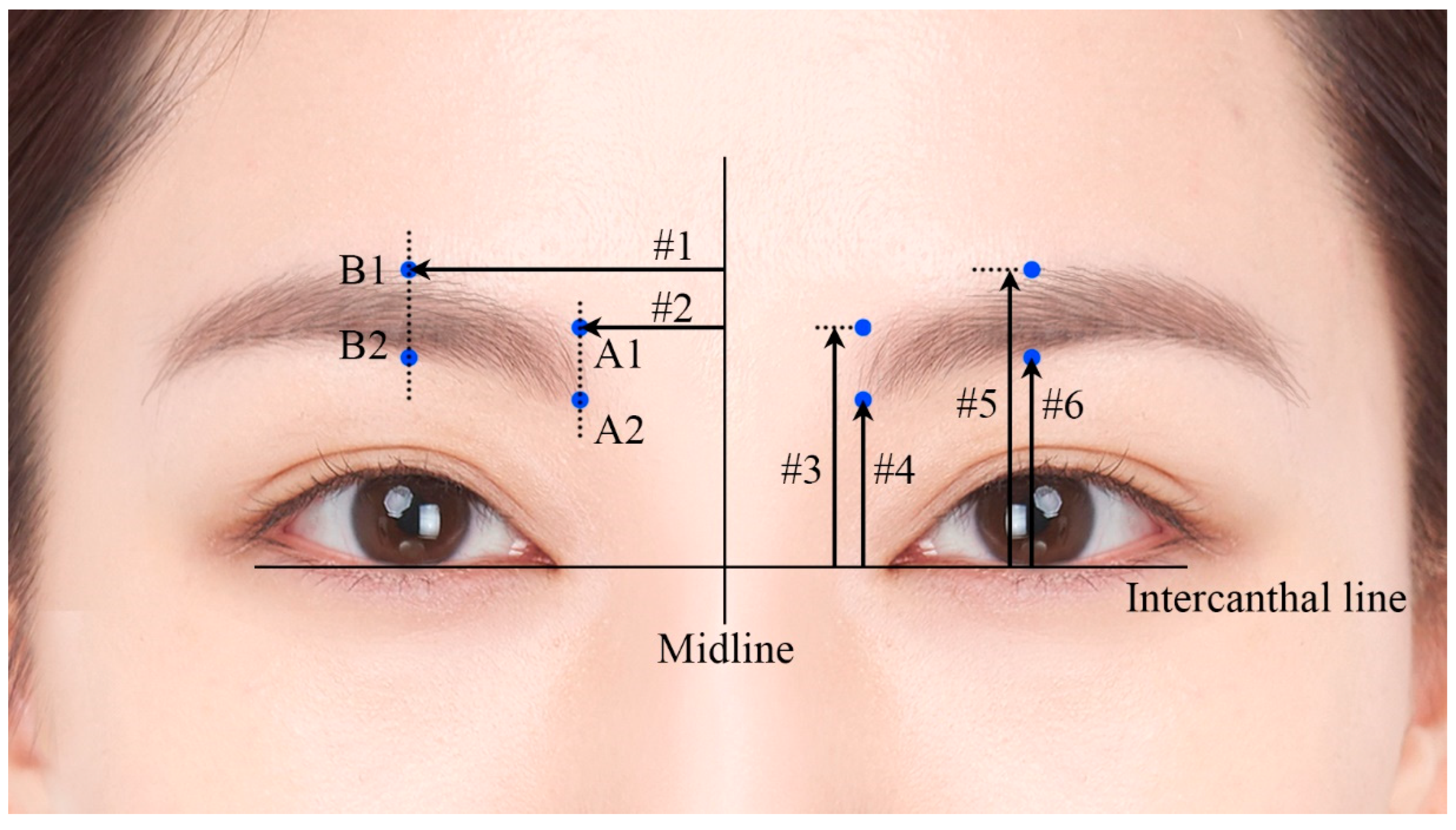 Toxins 17 00085 g003