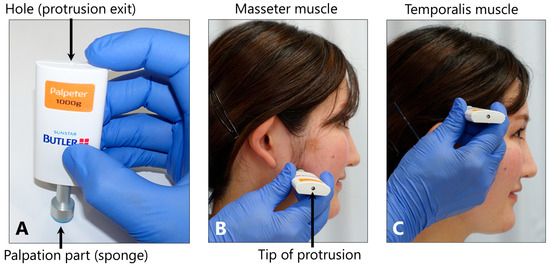 Toxins 17 00384 g013