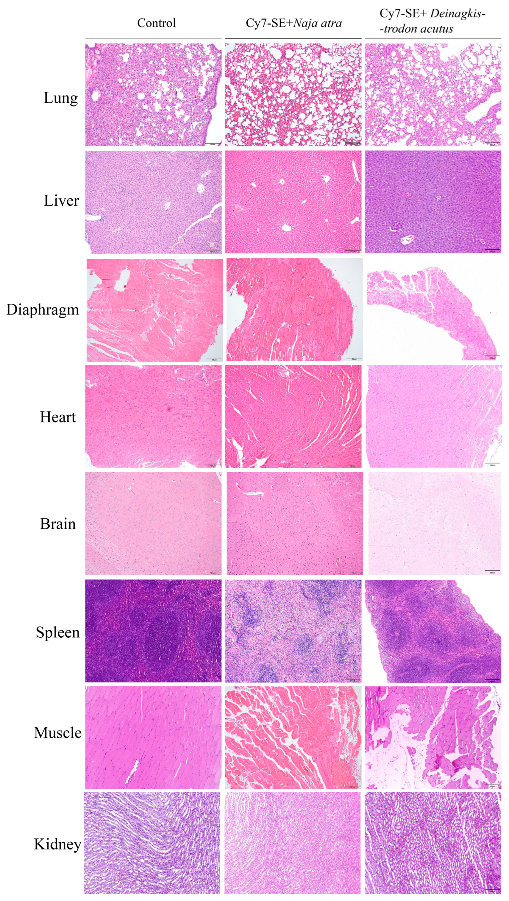Toxins 17 00559 g005 Toxins 17 00559 g005