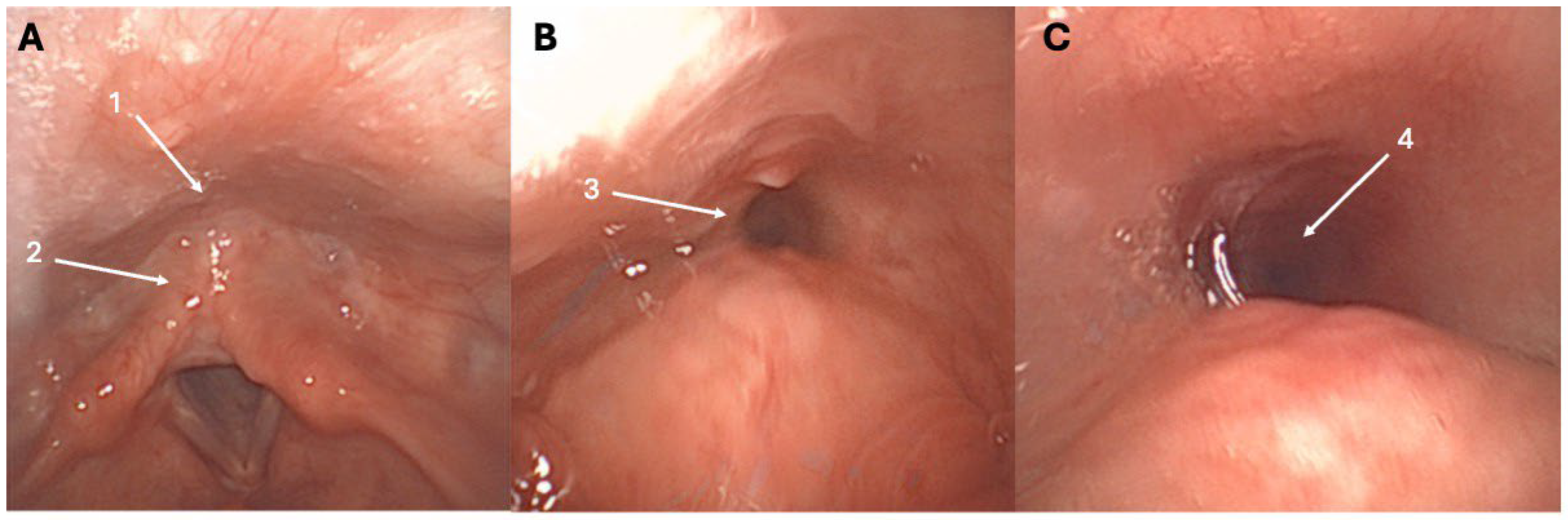 Toxins 18 00008 g001 Toxins 18 00008 g001