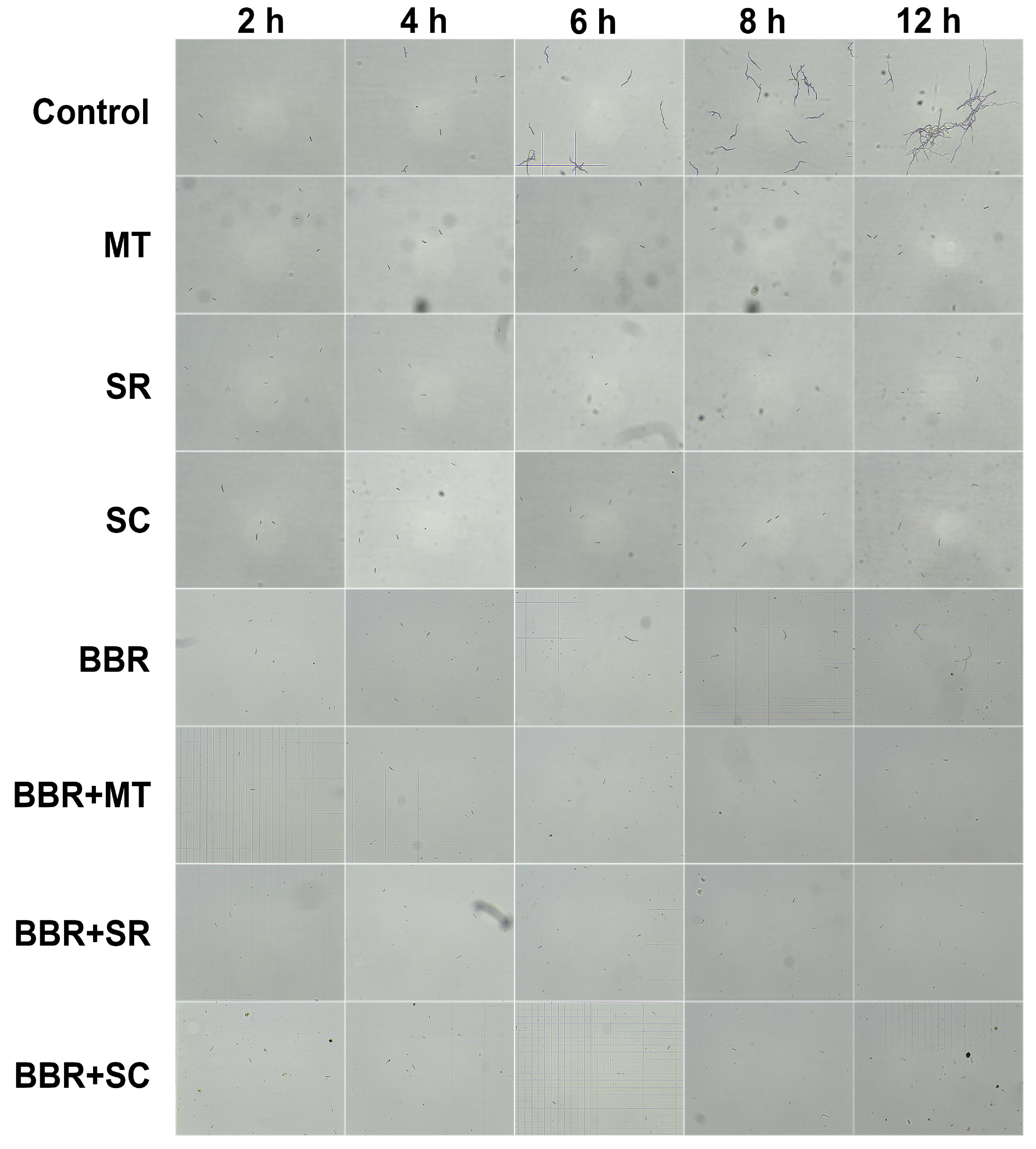 Toxins 18 00348 g003