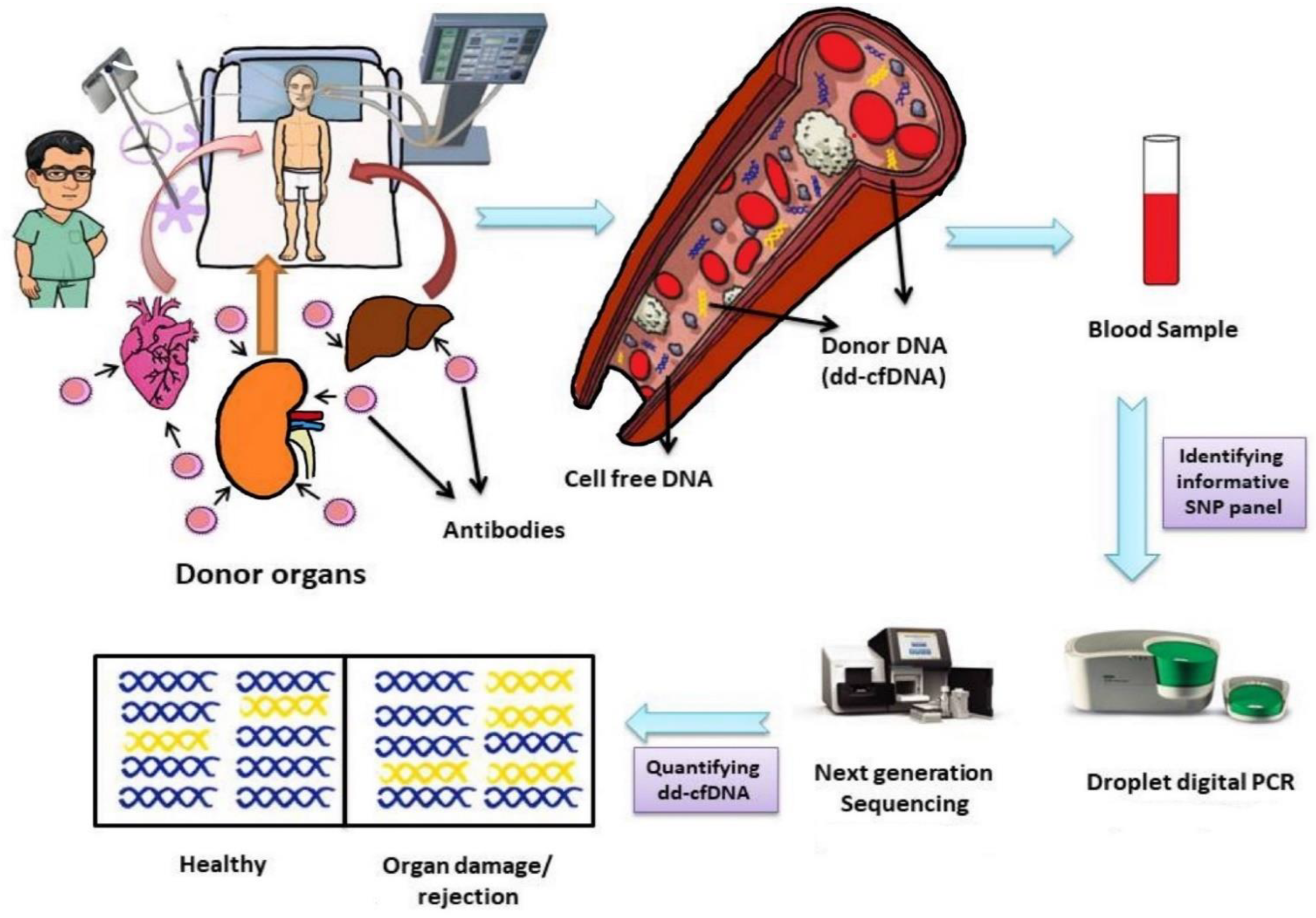 Transplantology 02 00034 g002