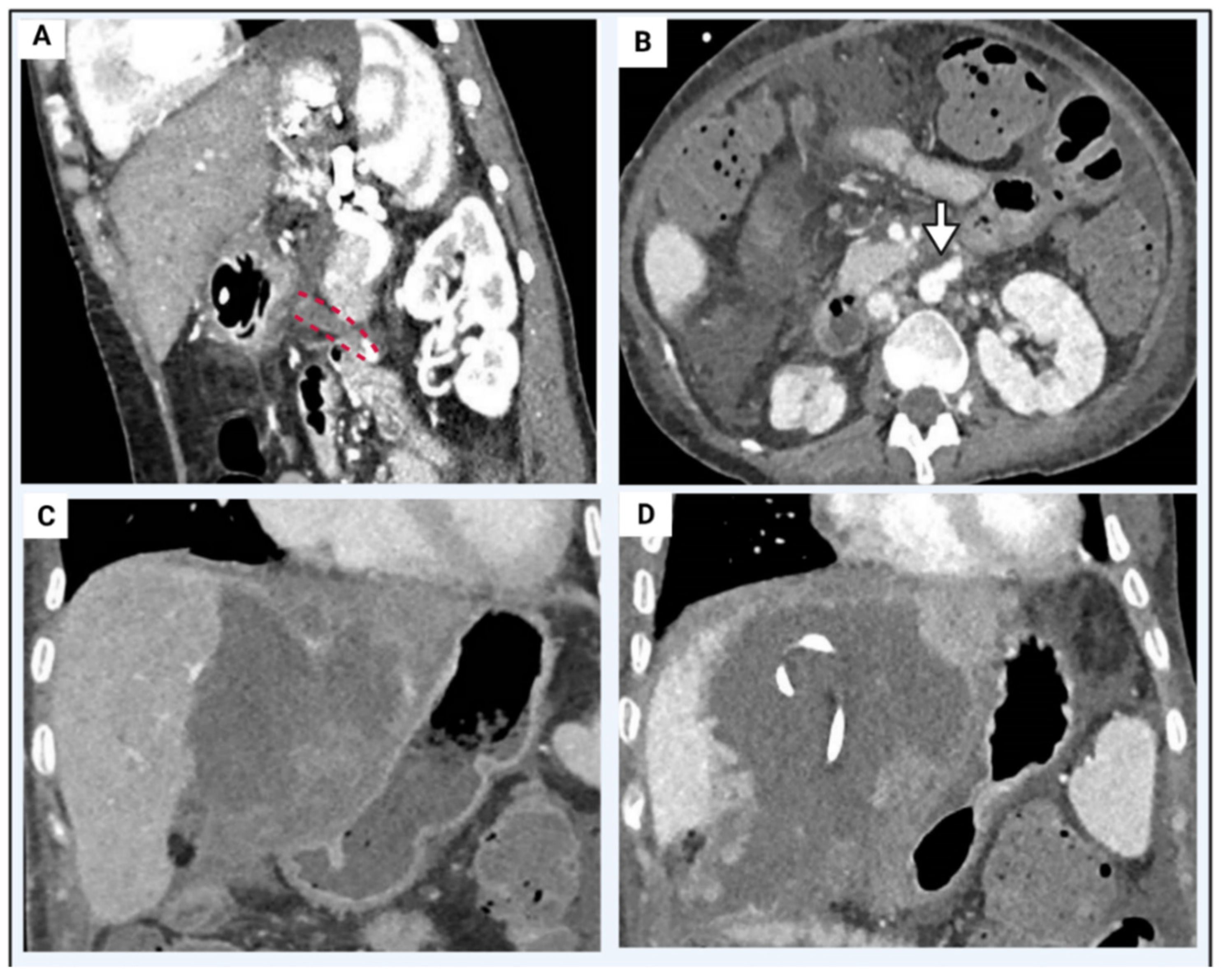 Transplantology 03 00018 g004