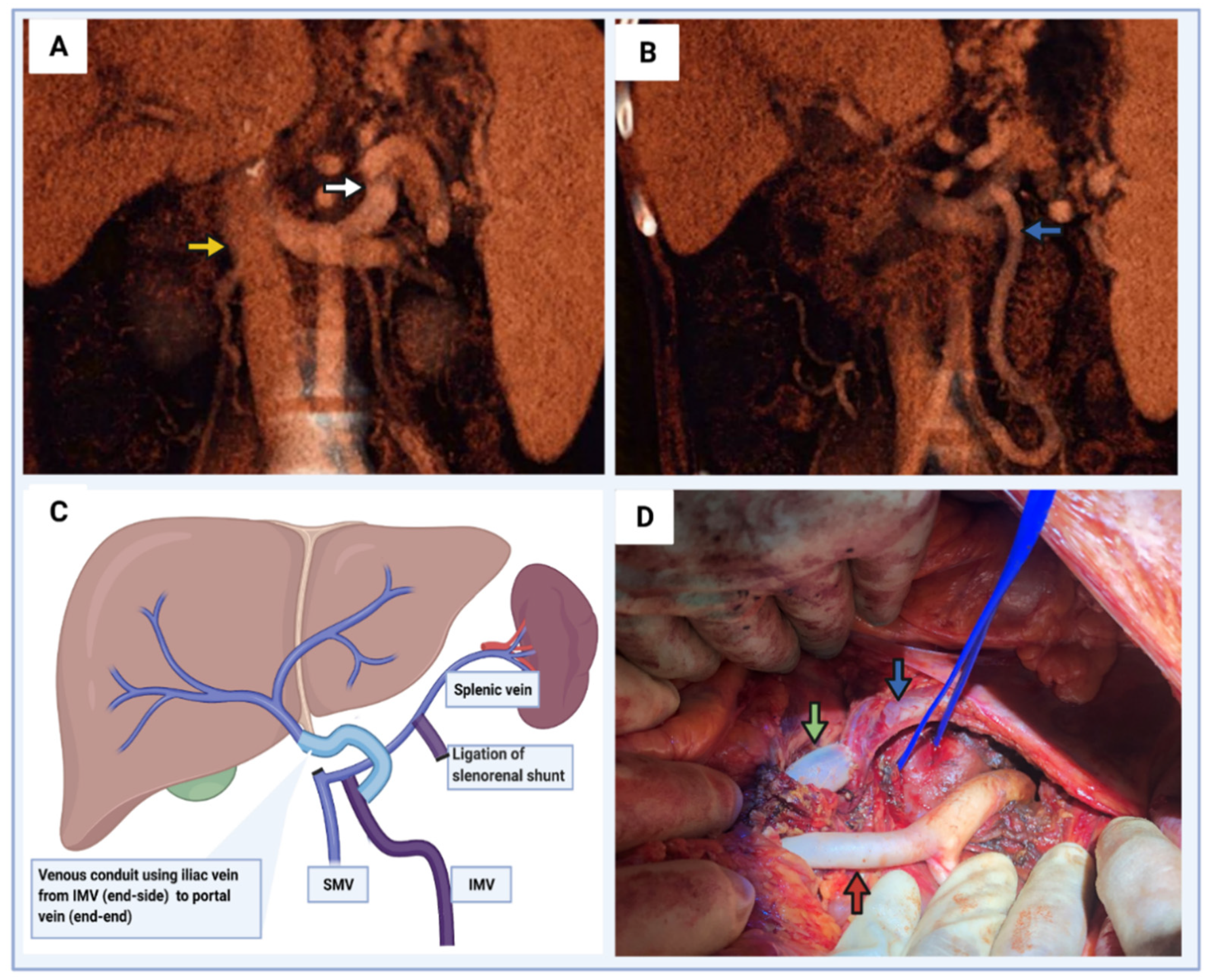 Transplantology 03 00018 g005