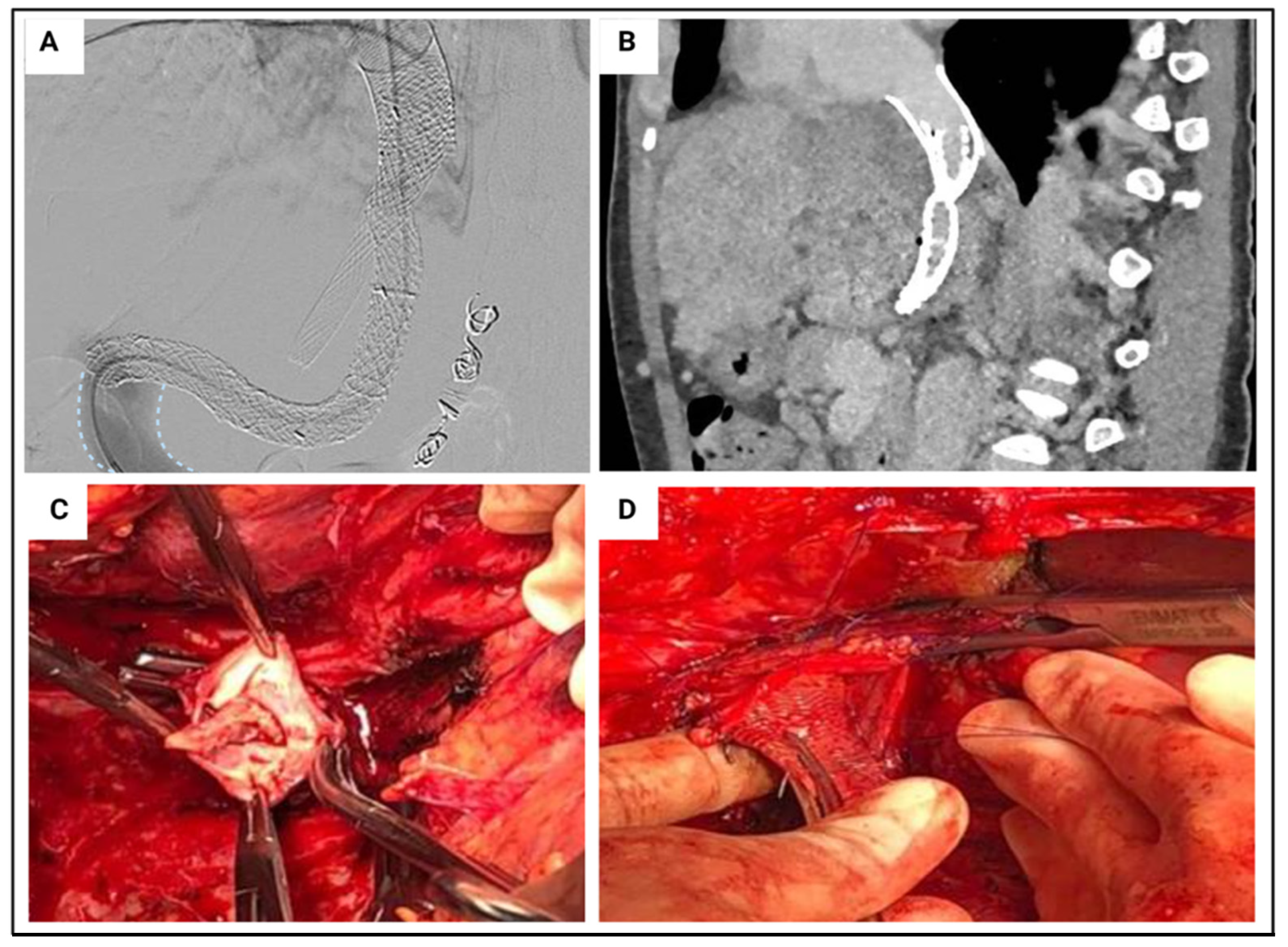 Transplantology 03 00018 g006