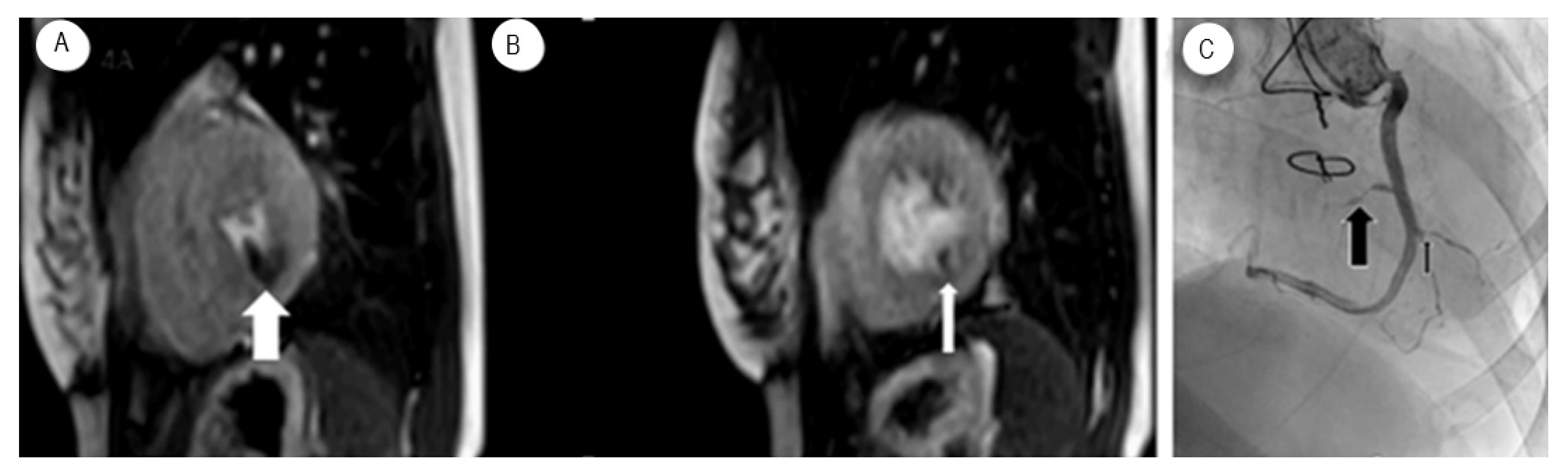 Transplantology 03 00025 g005