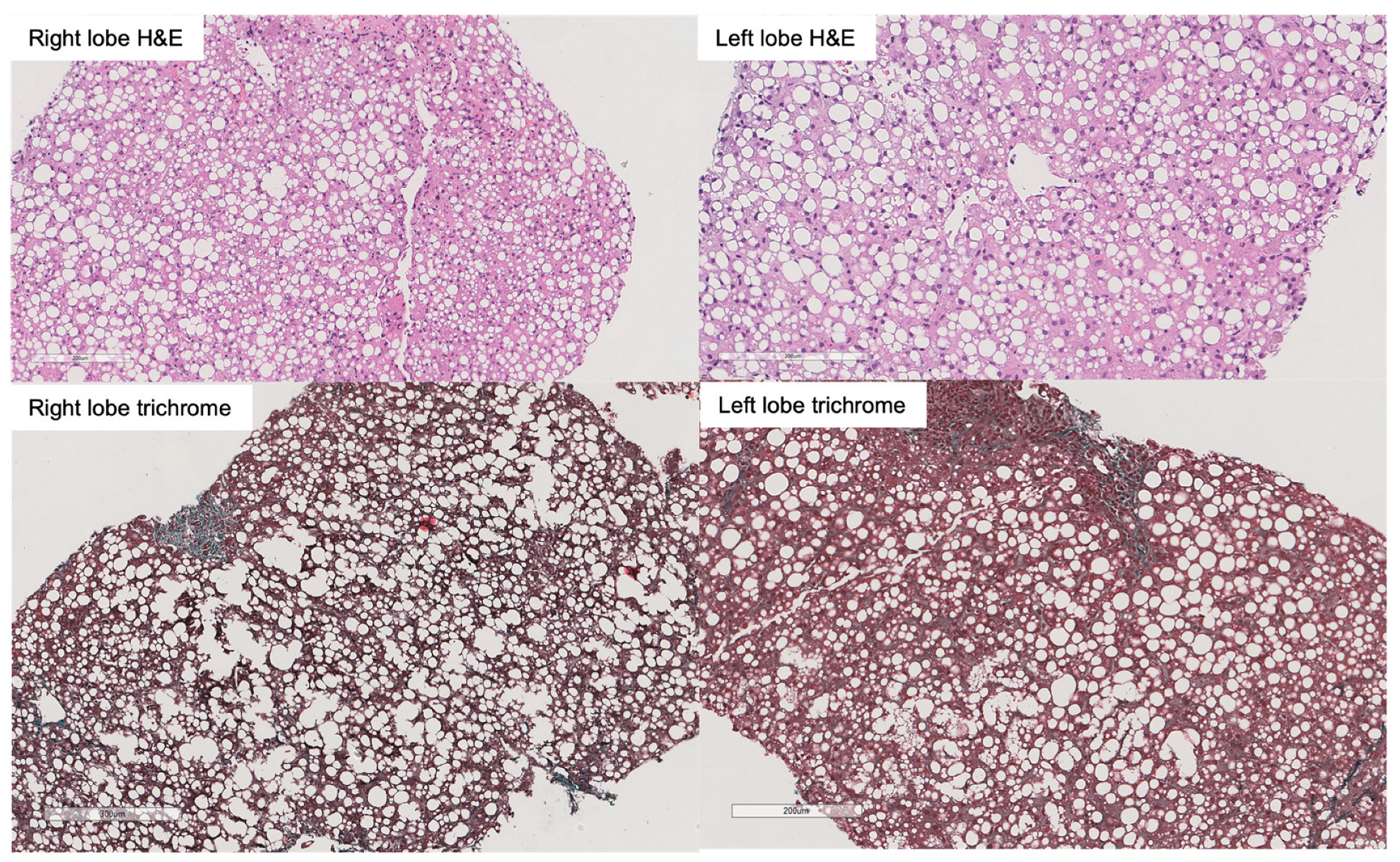 Transplantology 04 00015 g001