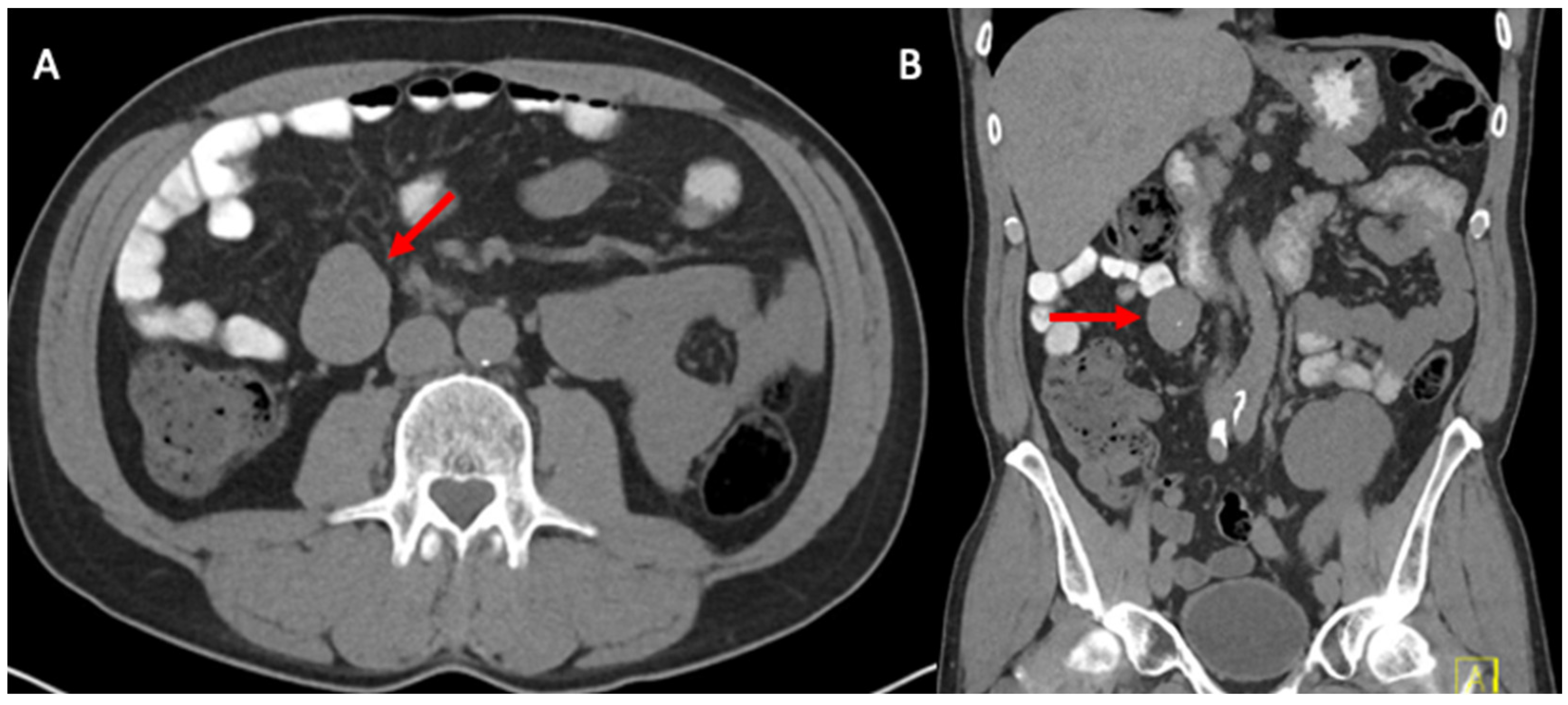 Transplantology 04 00017 g001