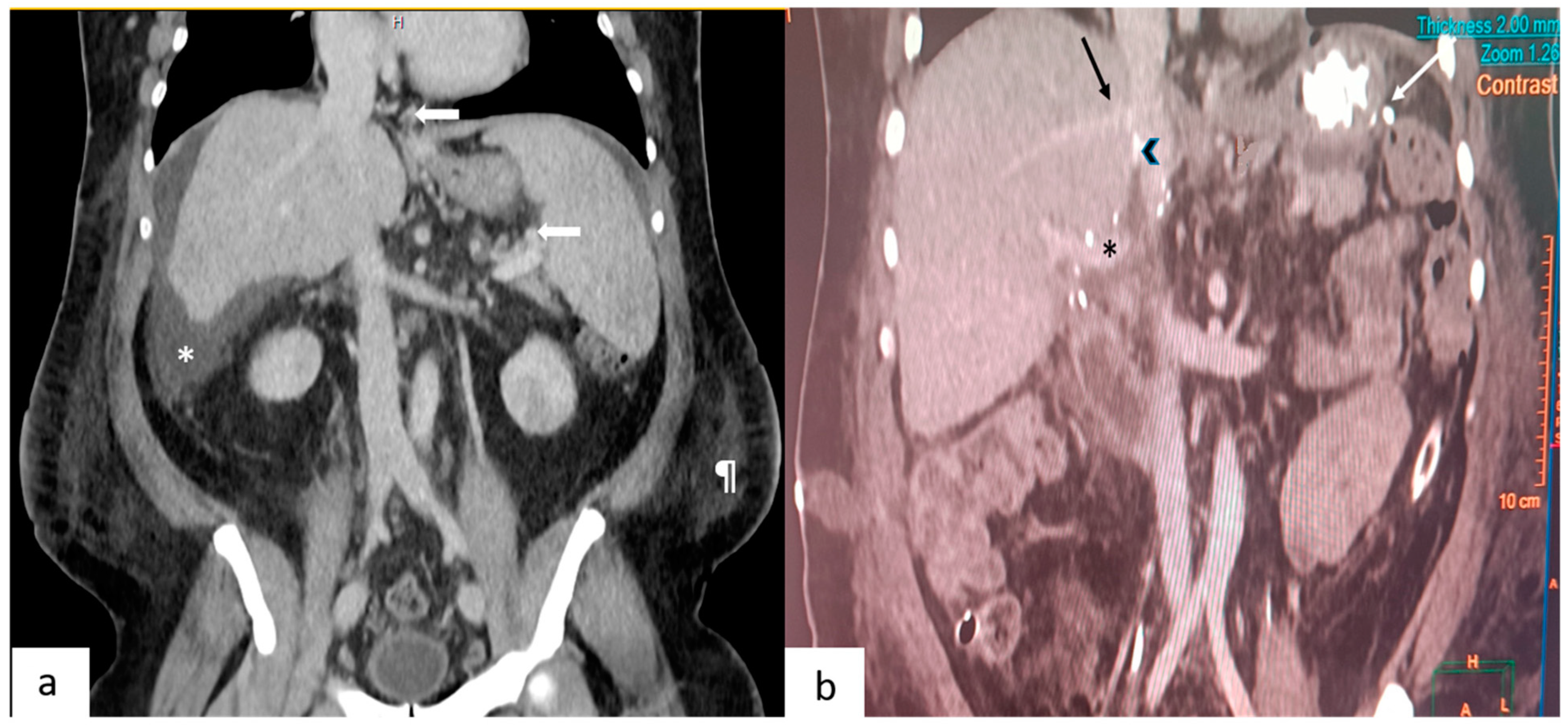 Transplantology 05 00025 g001