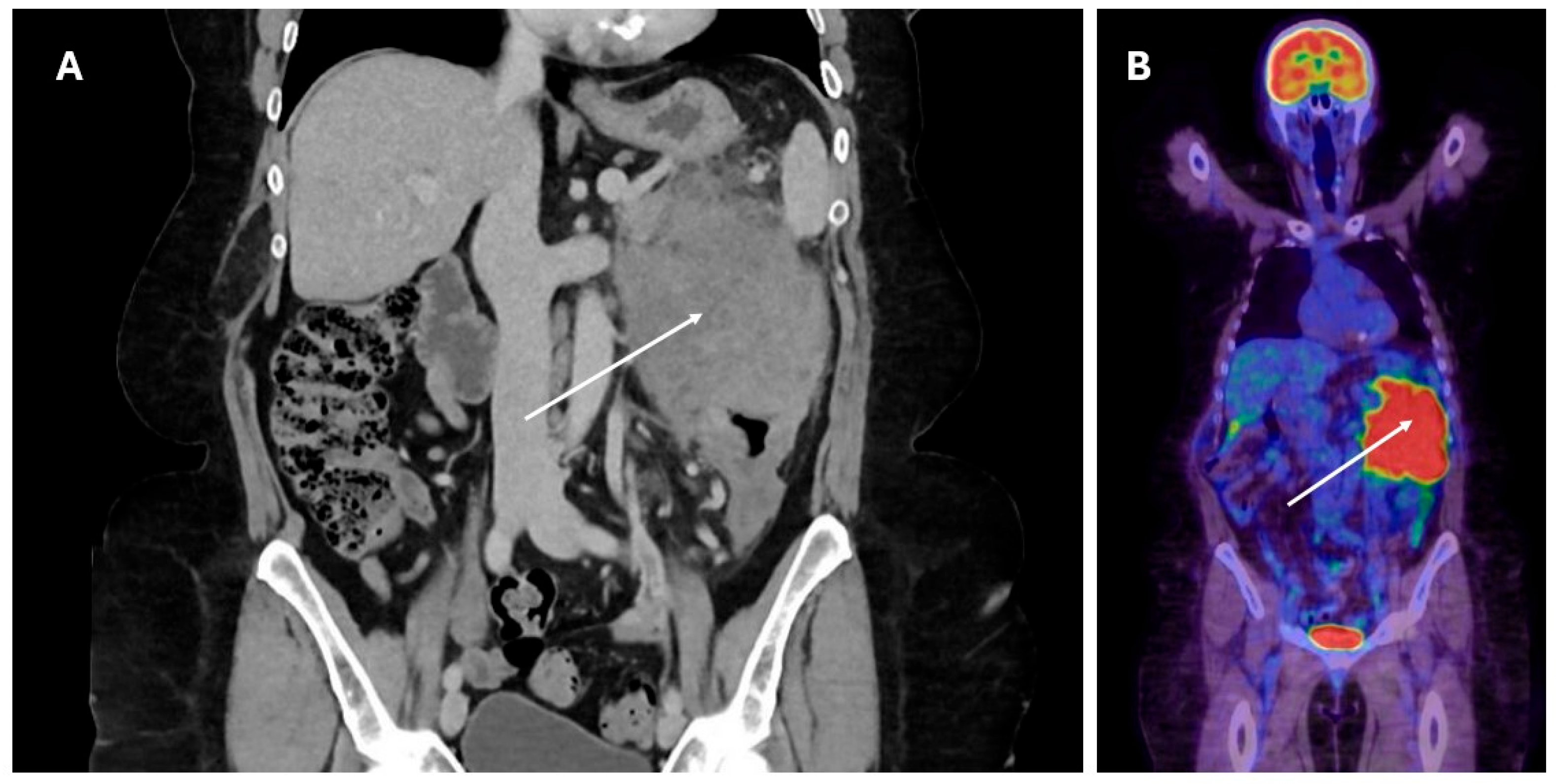Transplantology 06 00018 g001