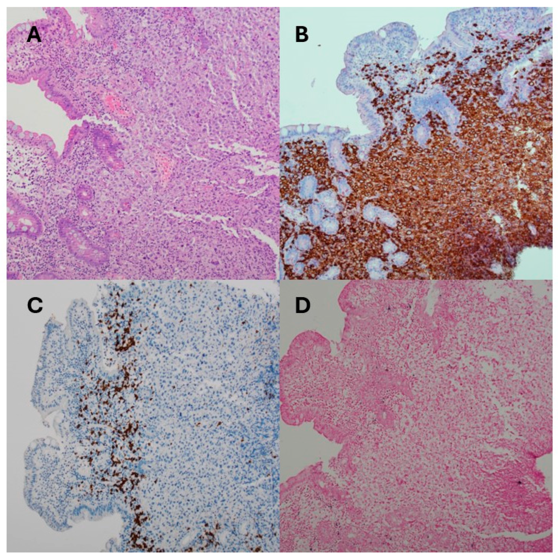 Transplantology 06 00018 g002