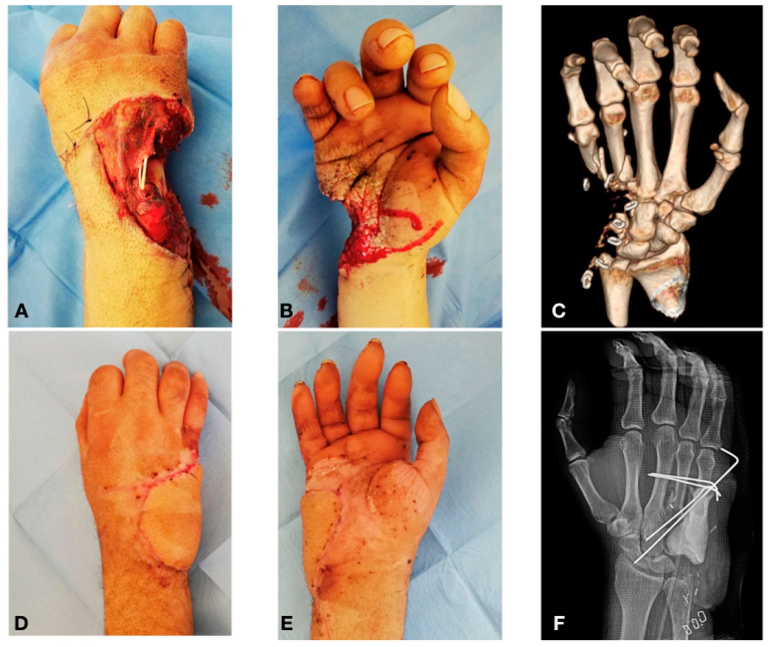 Traumacare 01 00002 g002