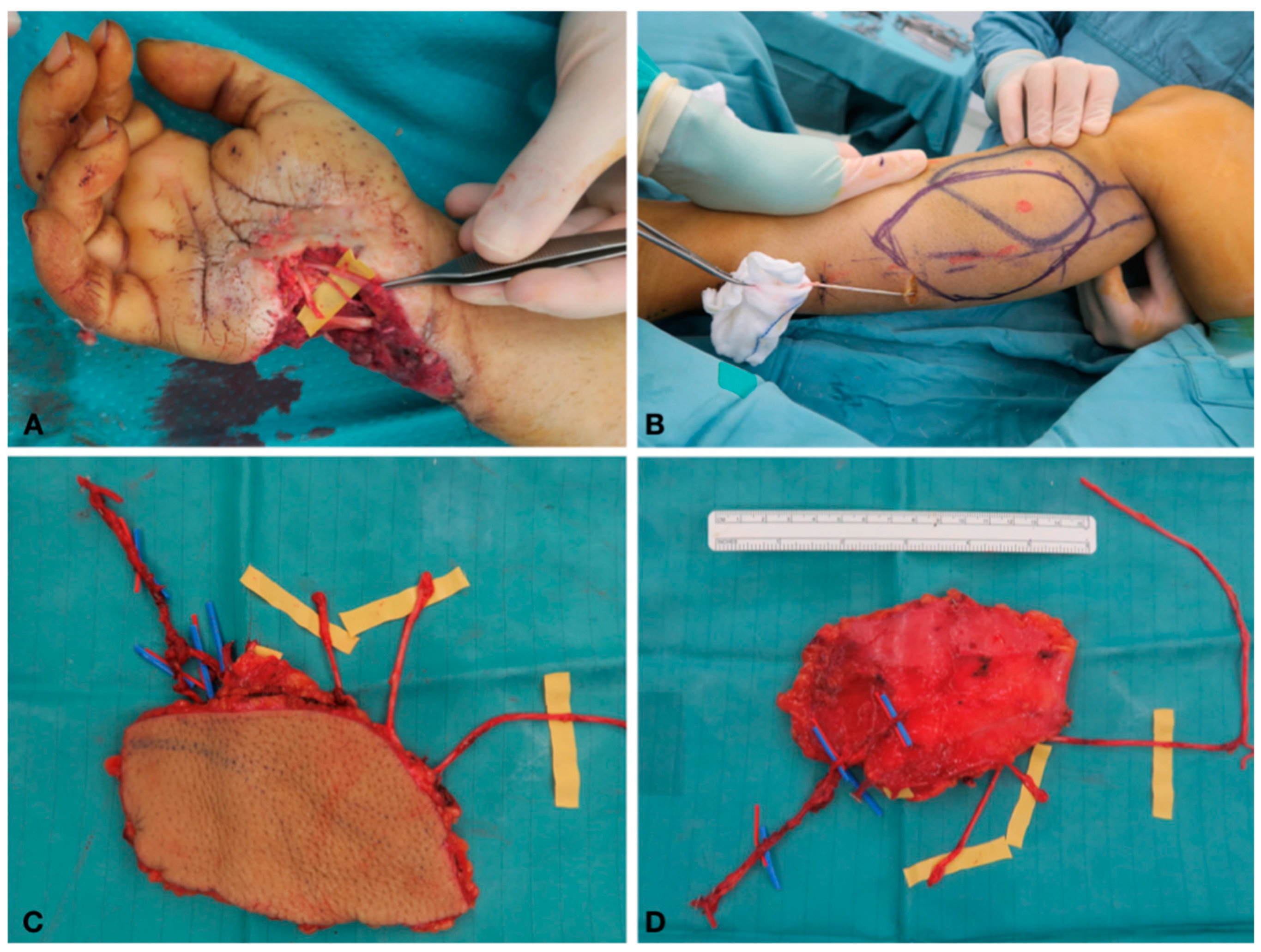 Traumacare 01 00002 g003