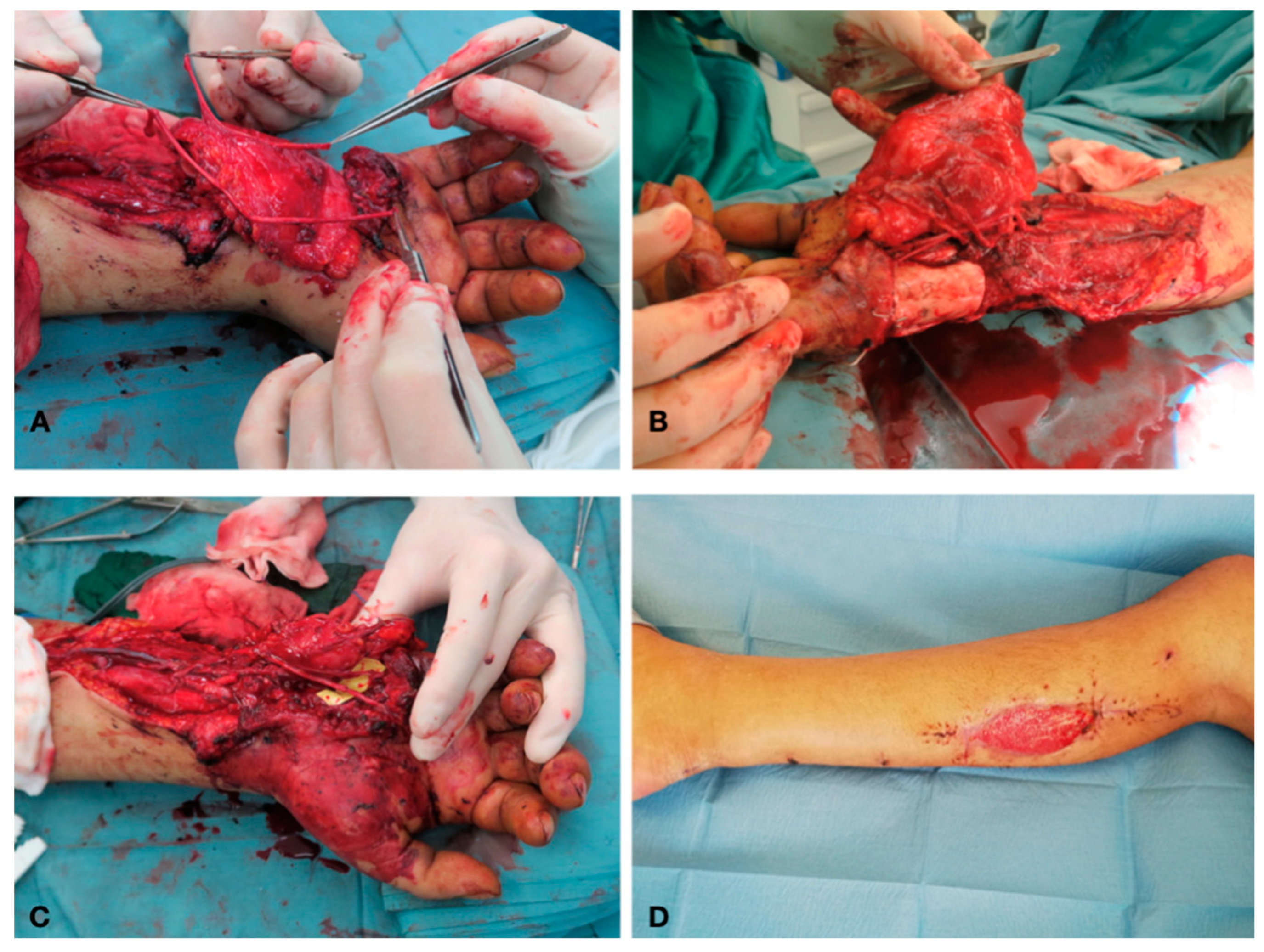 Traumacare 01 00002 g004