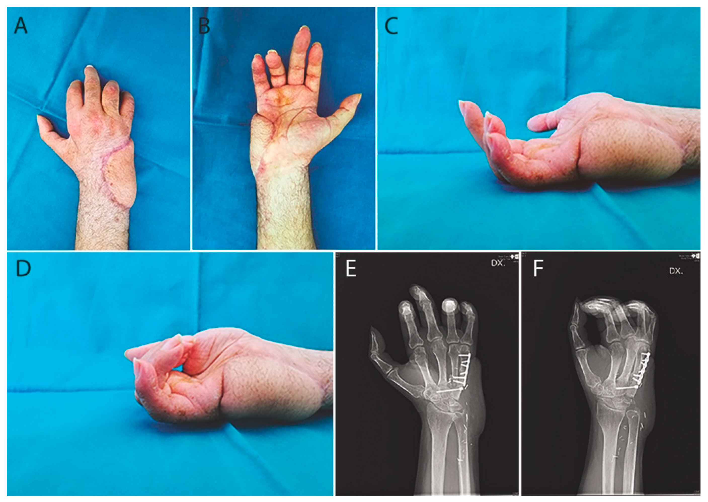 Traumacare 01 00002 g005