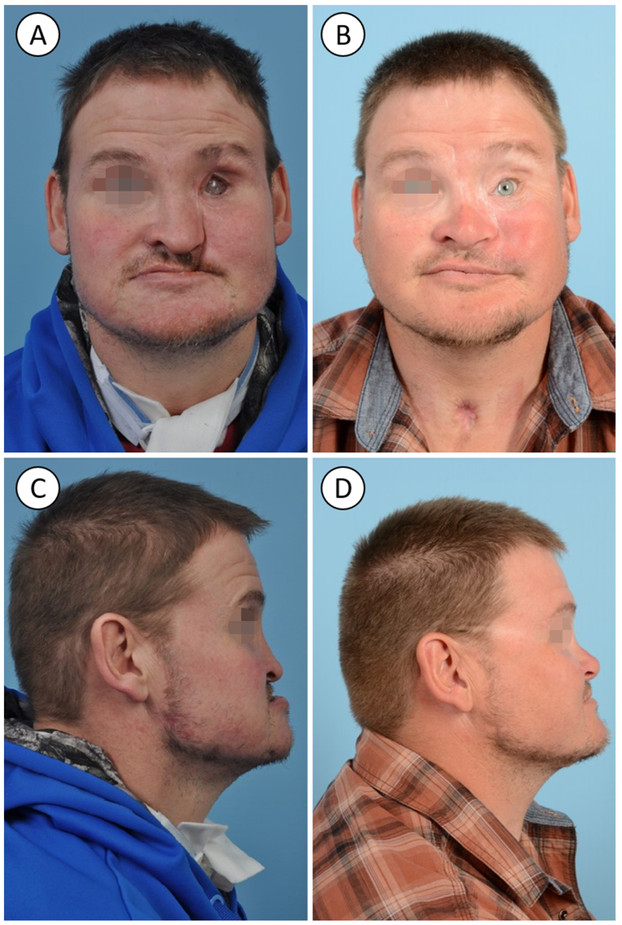 Traumacare 02 00018 g003