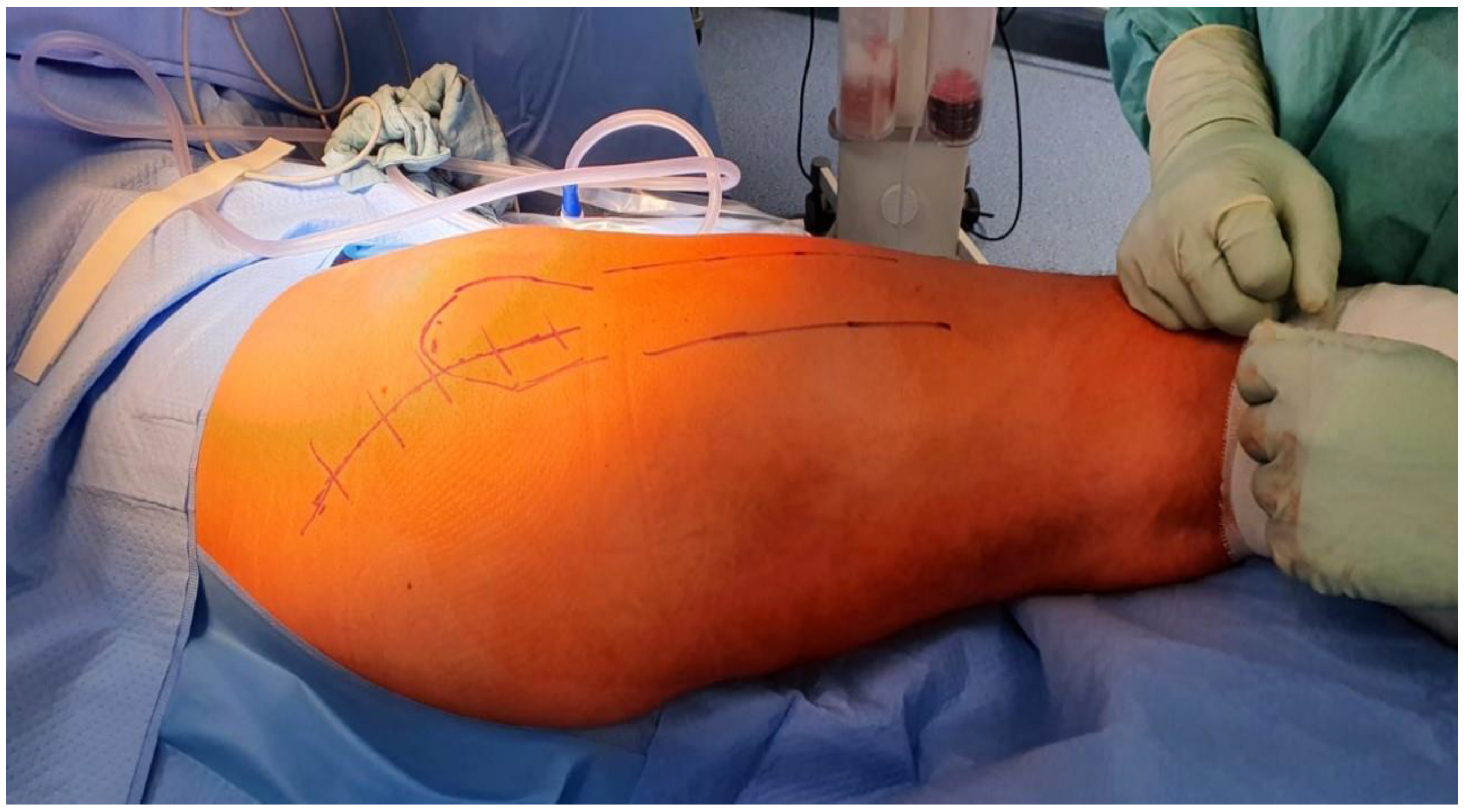 Traumacare 02 00038 g003