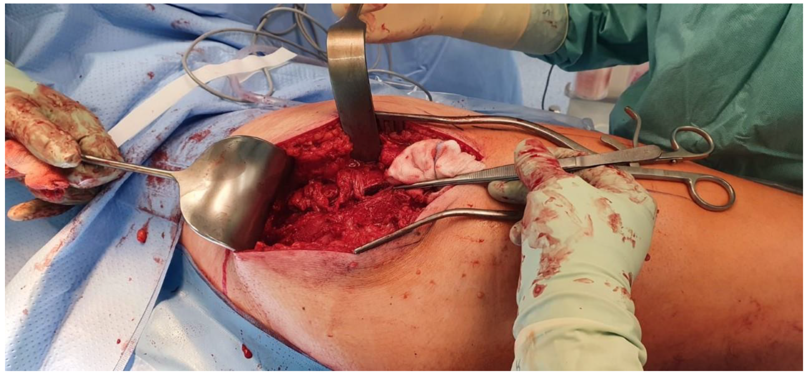 Traumacare 02 00038 g004