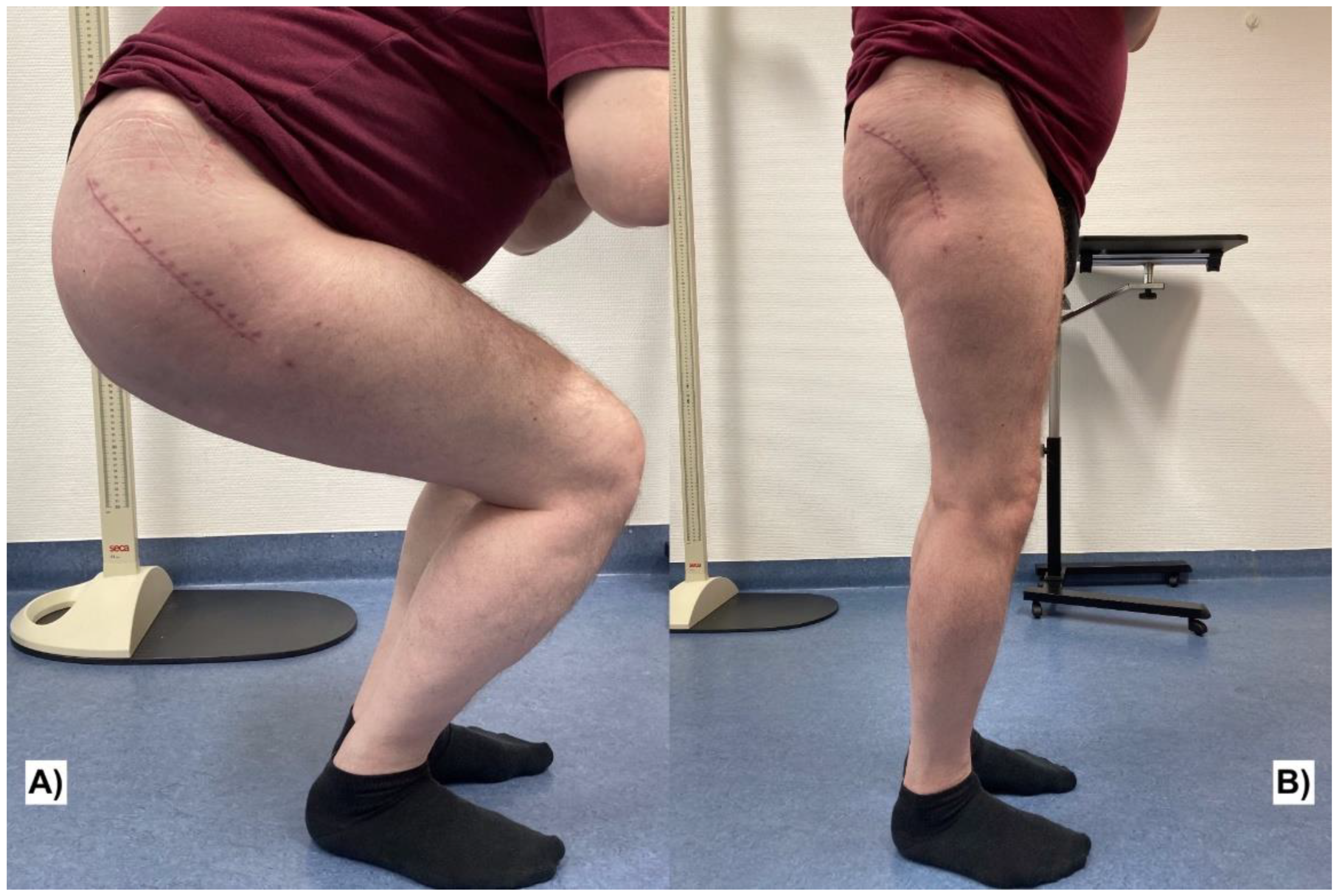 Traumacare 02 00038 g005