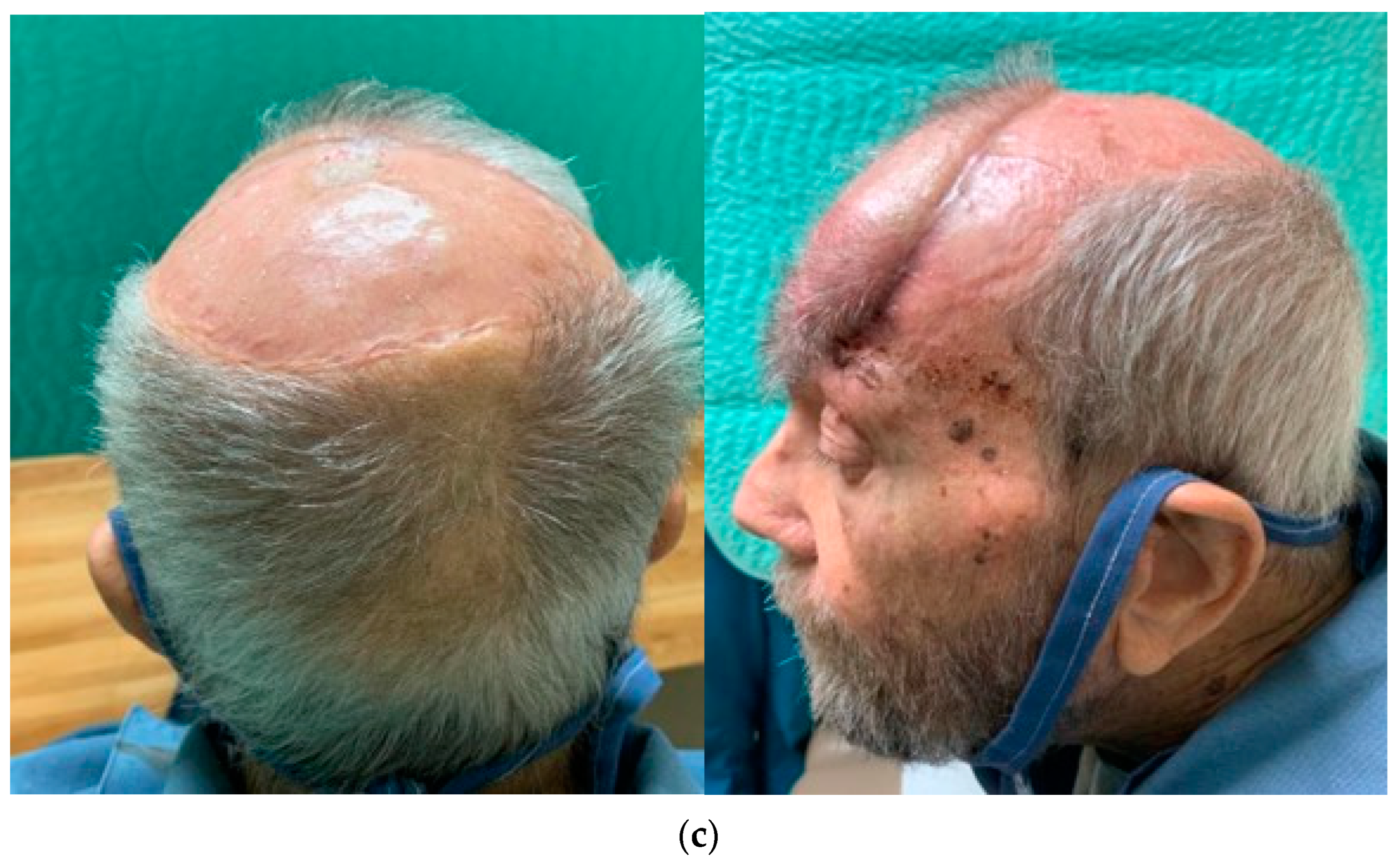 Traumacare 04 00012 g003b