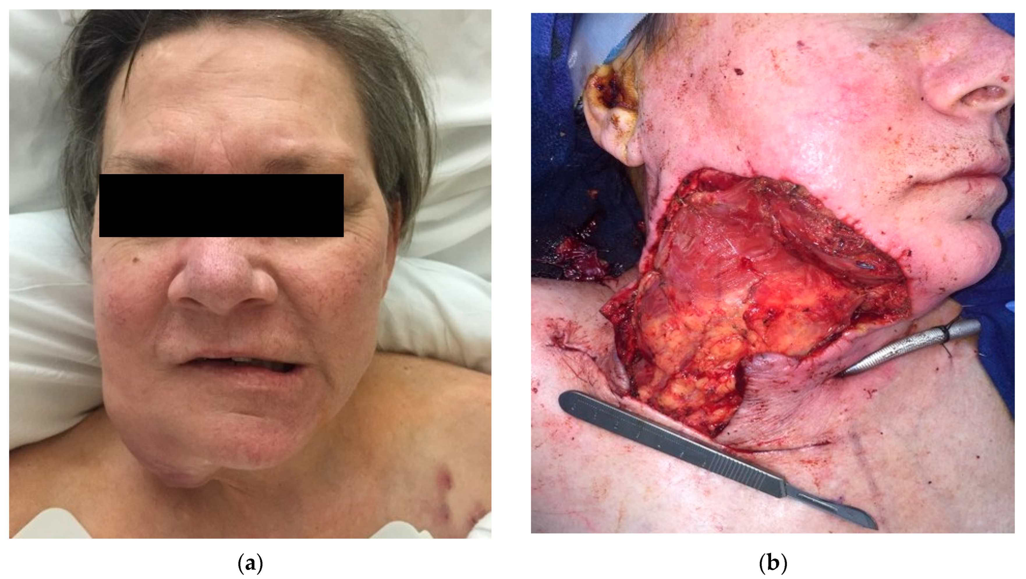 Traumacare 04 00012 g004a