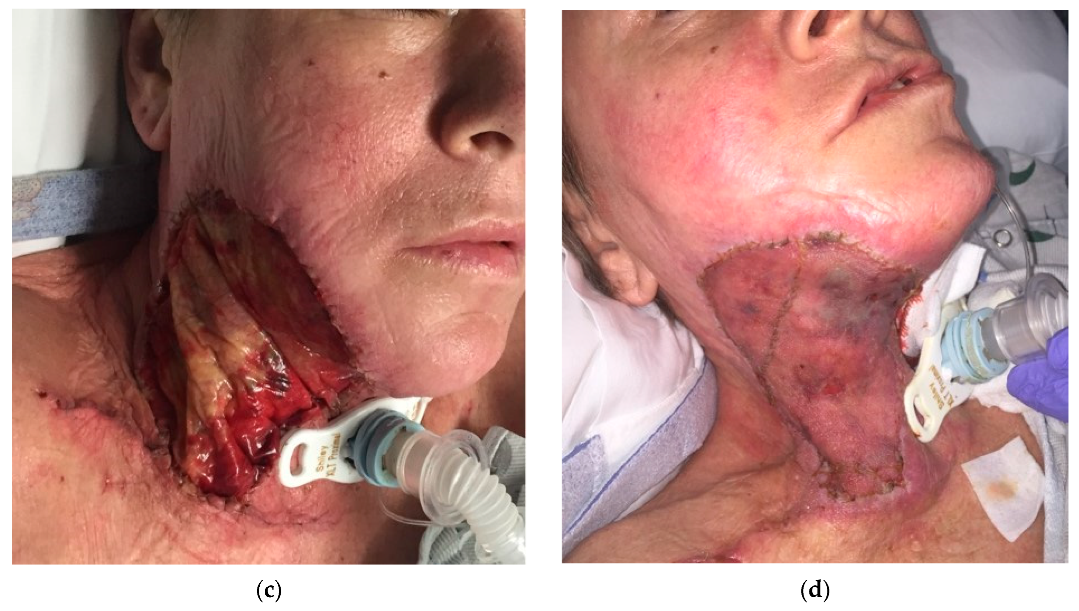 Traumacare 04 00012 g004b