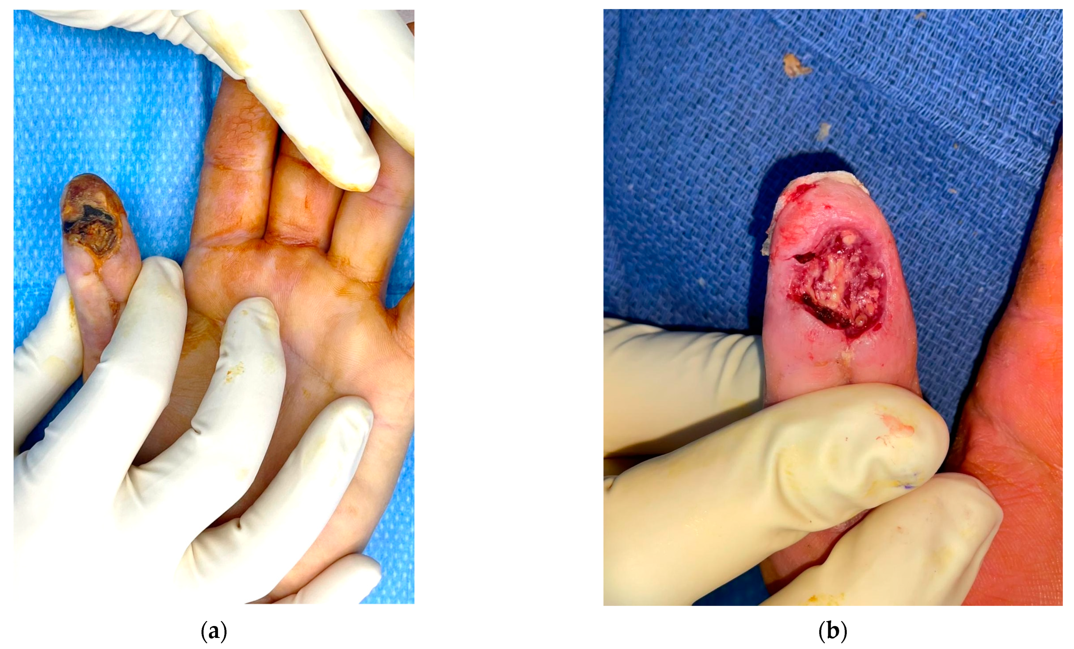 Traumacare 04 00012 g005a