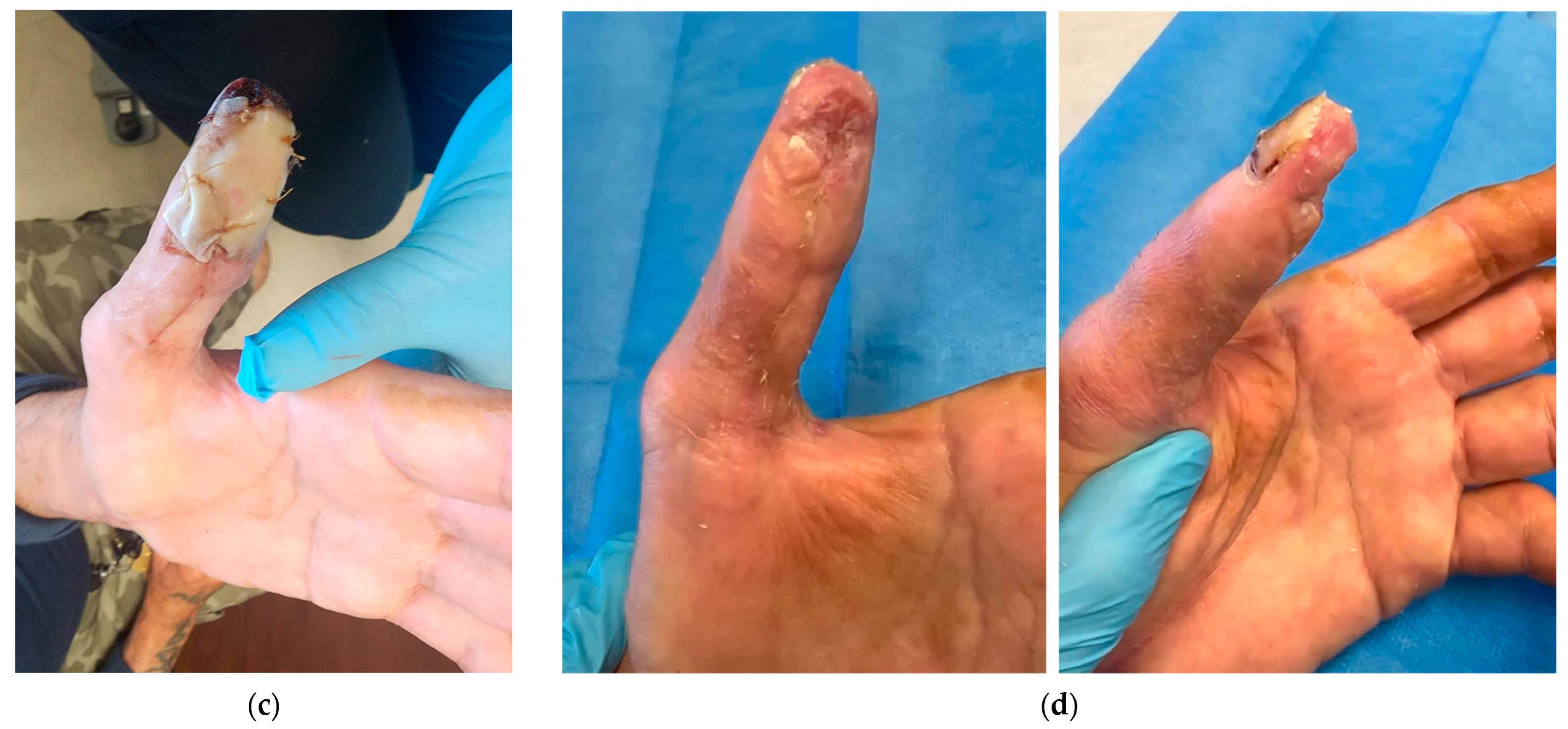 Traumacare 04 00012 g005b
