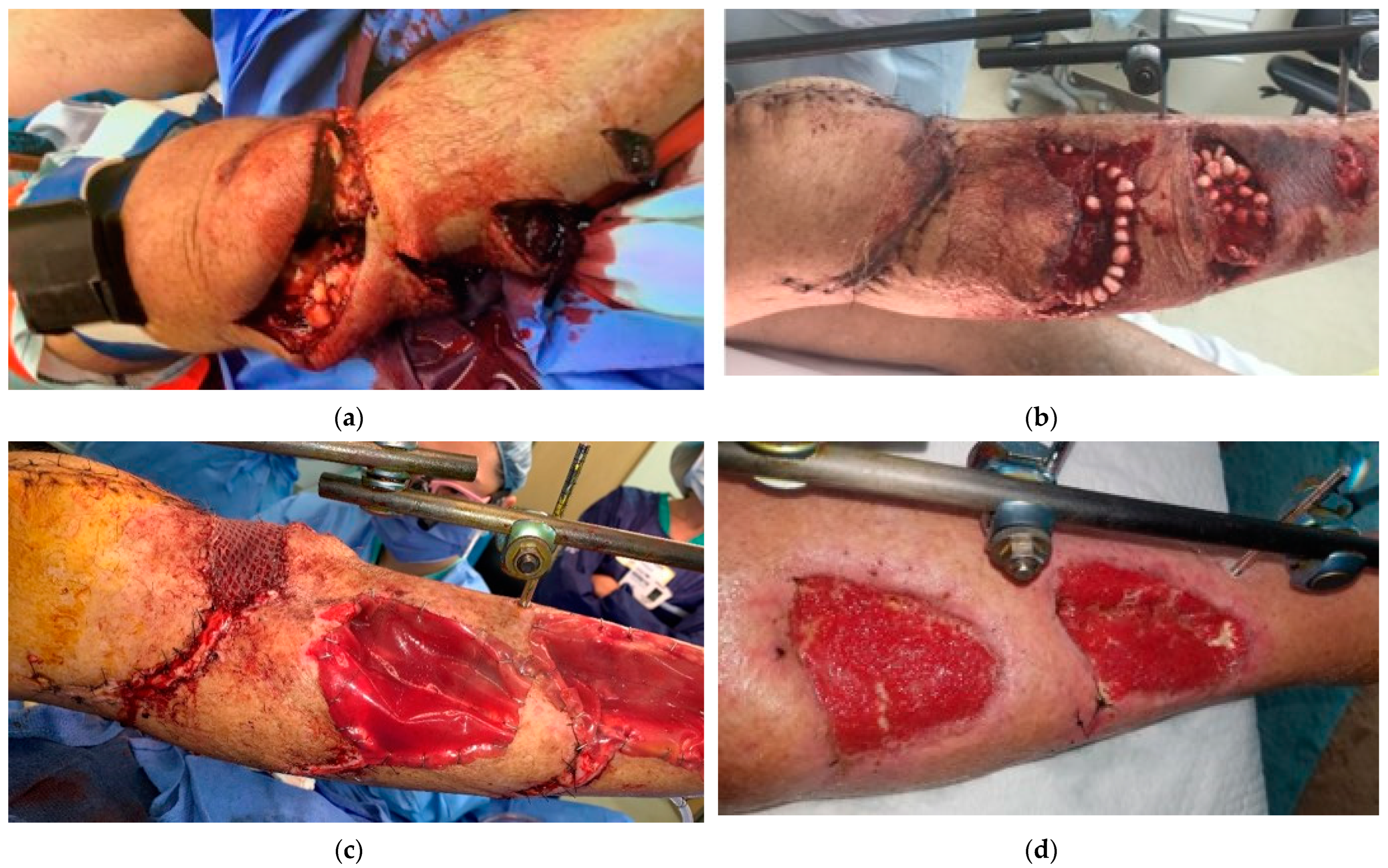 Traumacare 04 00012 g006a