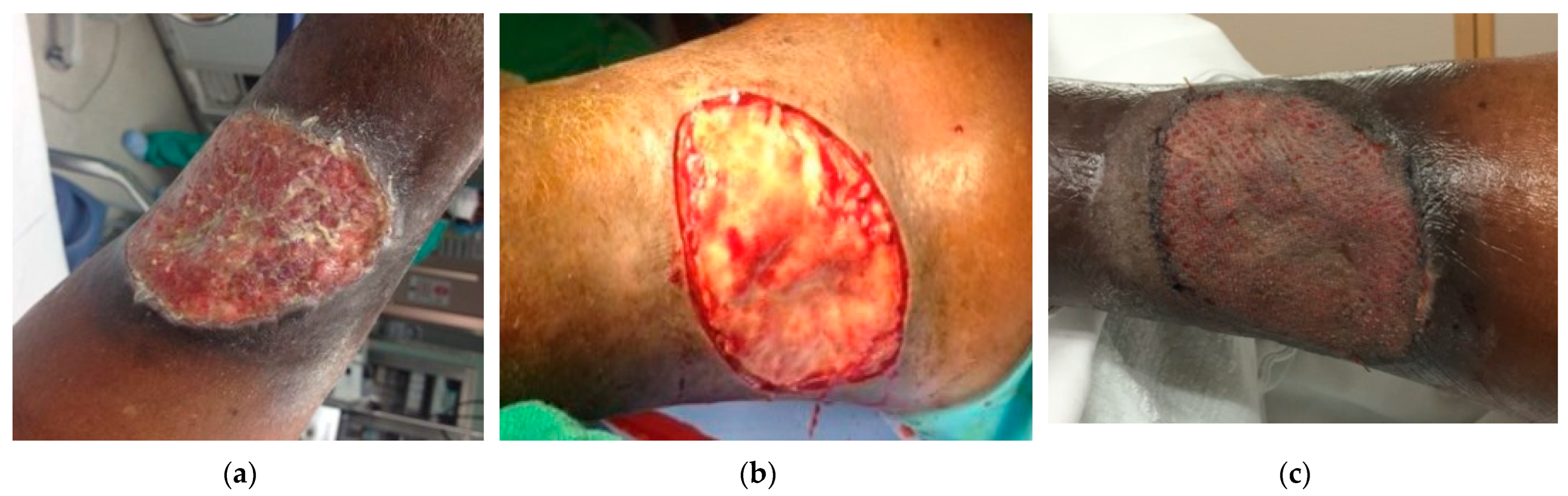 Traumacare 04 00012 g007