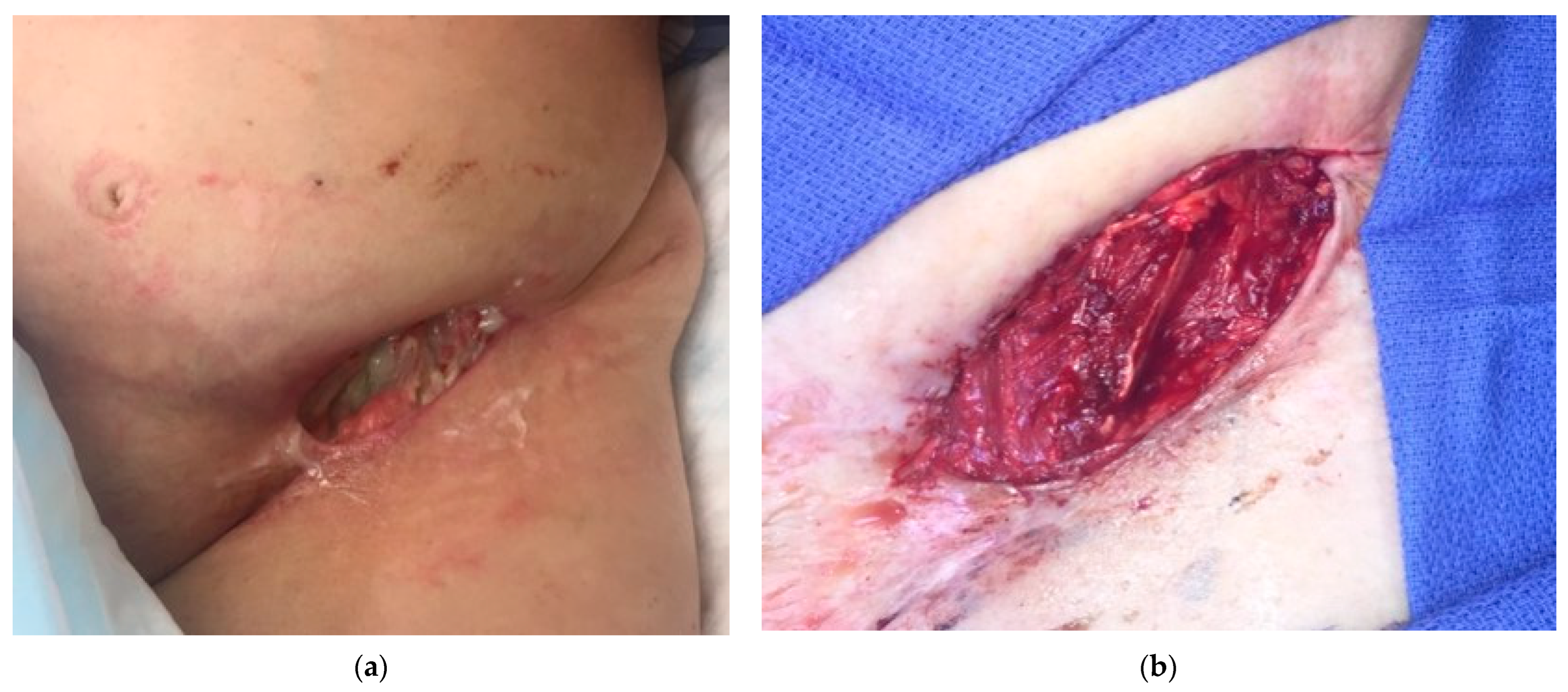 Traumacare 04 00012 g009a