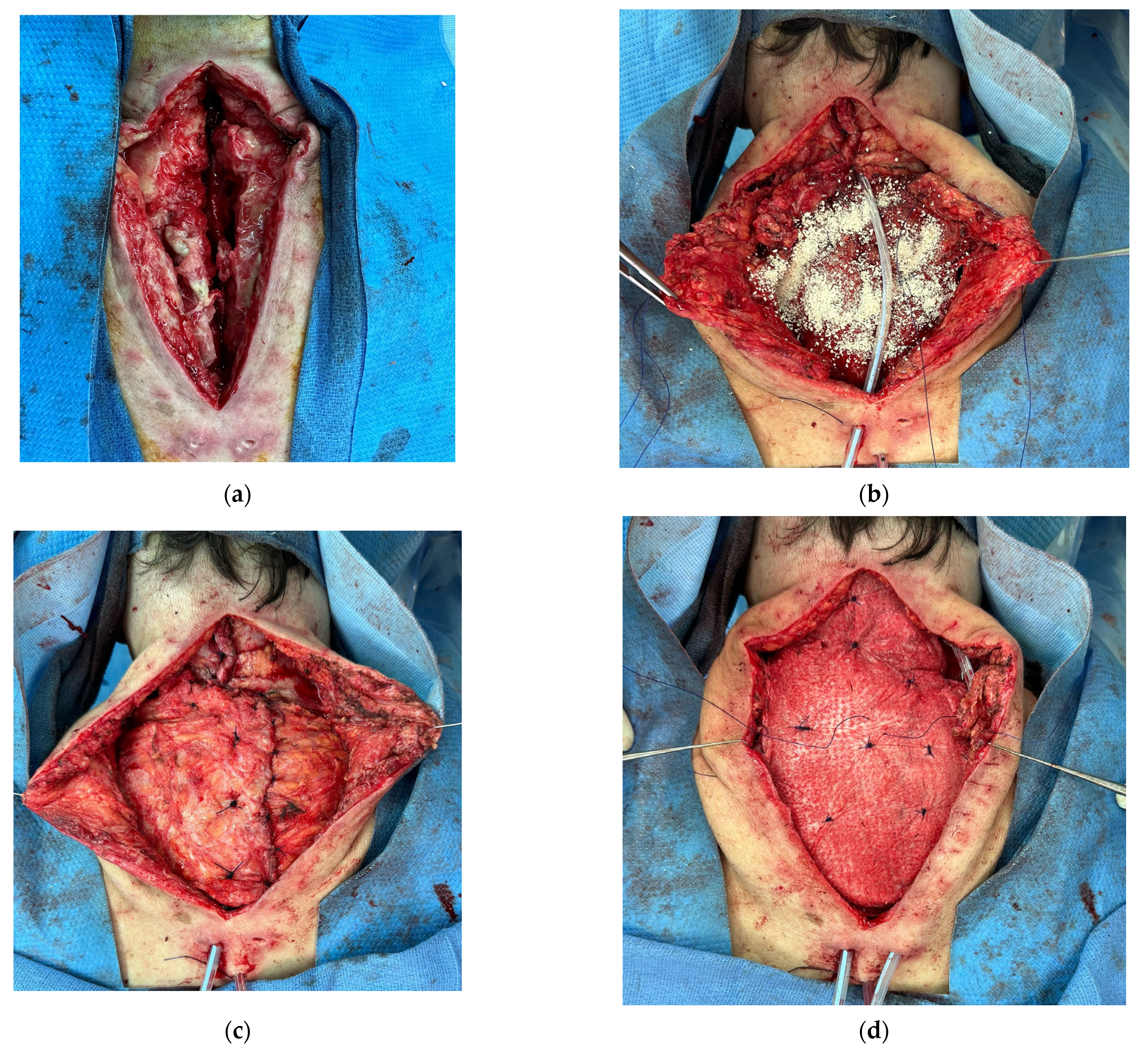 Traumacare 04 00012 g010a