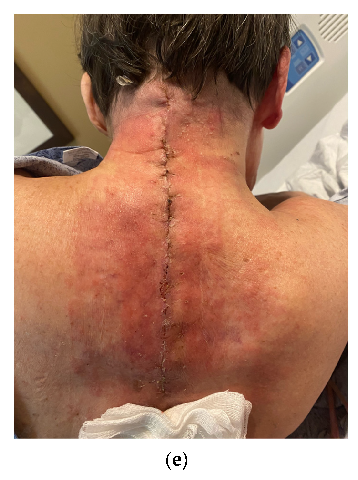 Traumacare 04 00012 g010b