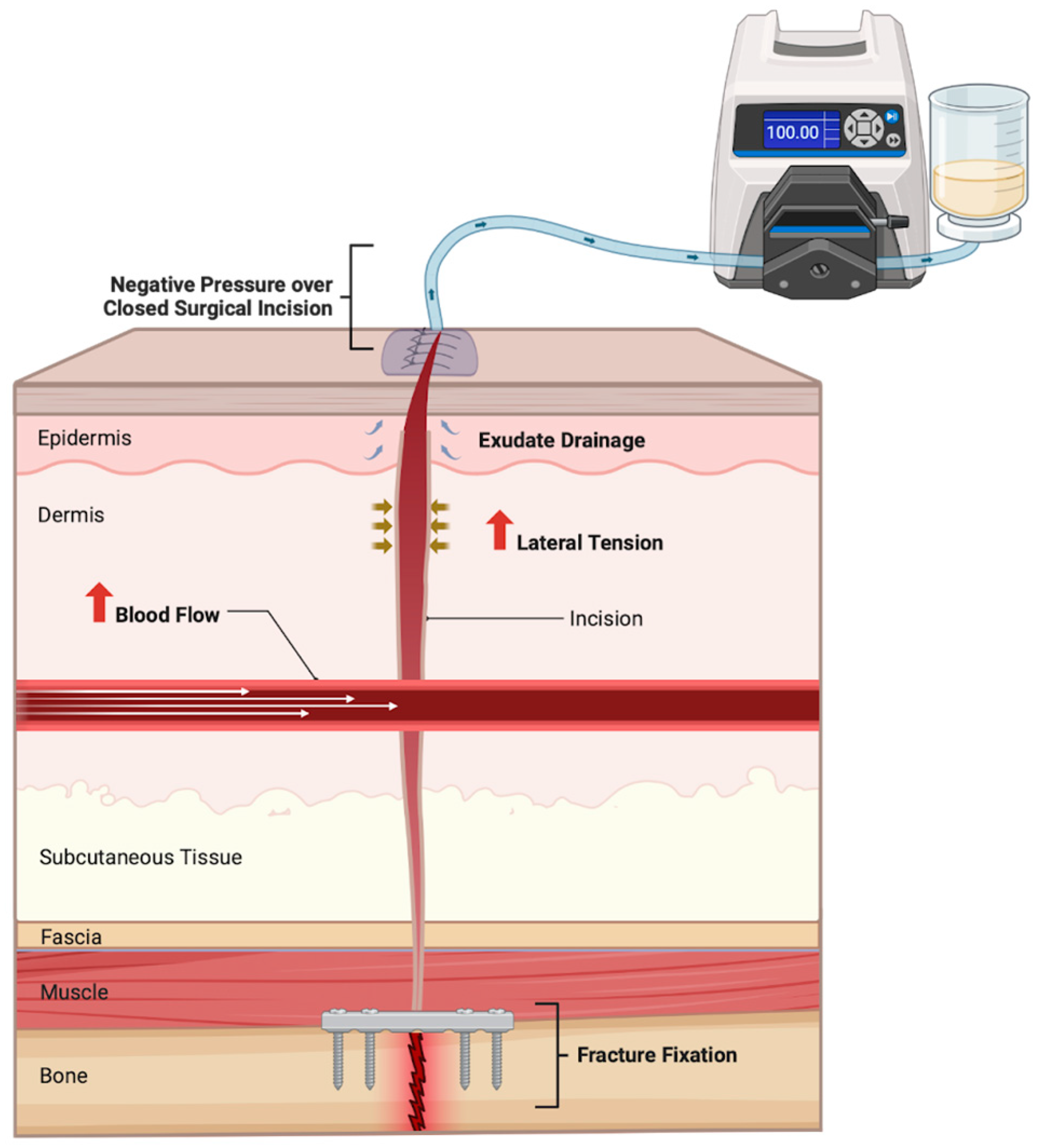 Traumacare 05 00011 g001 Traumacare 05 00011 g001