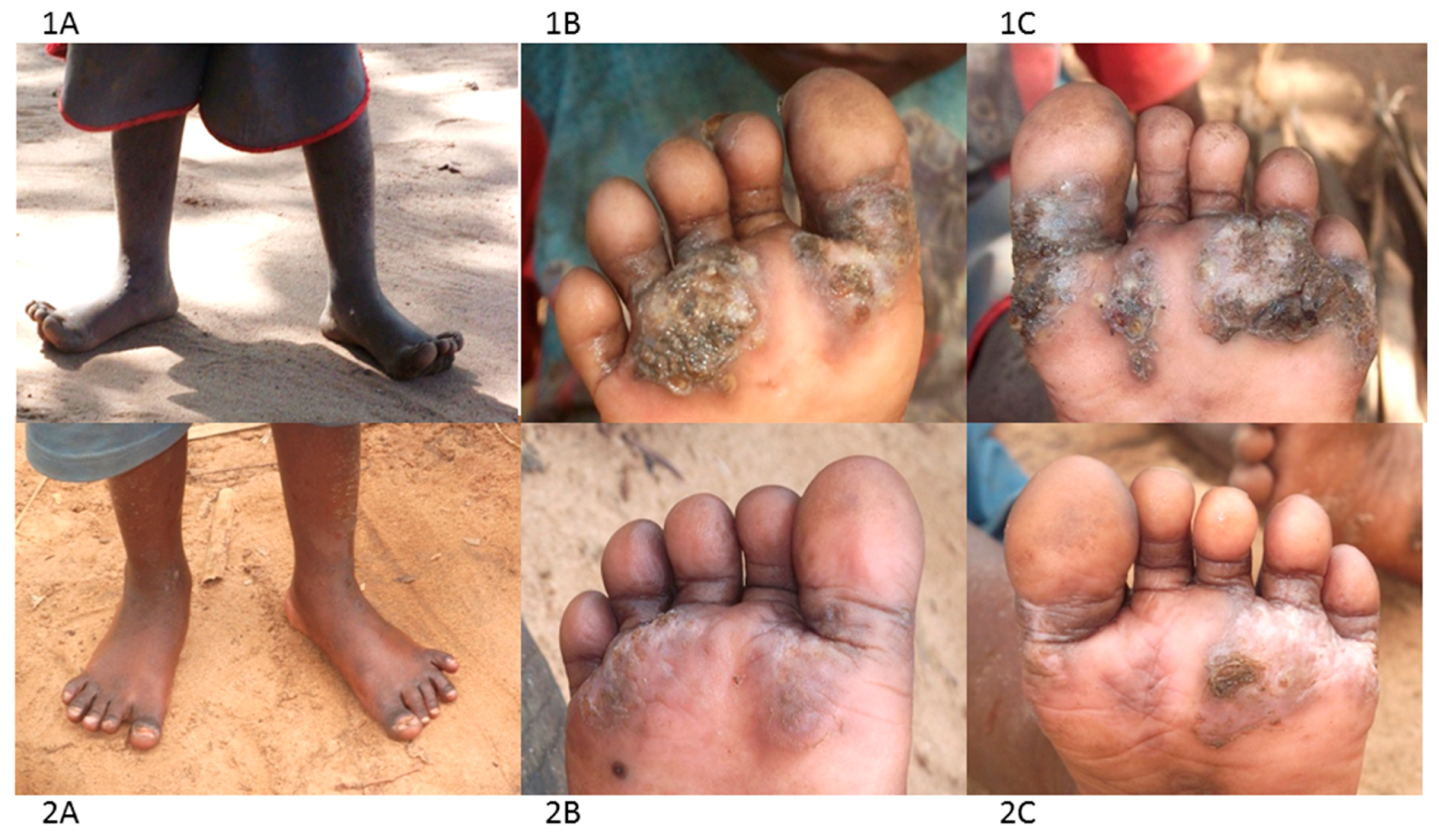 Tropicalmed 02 00033 g003